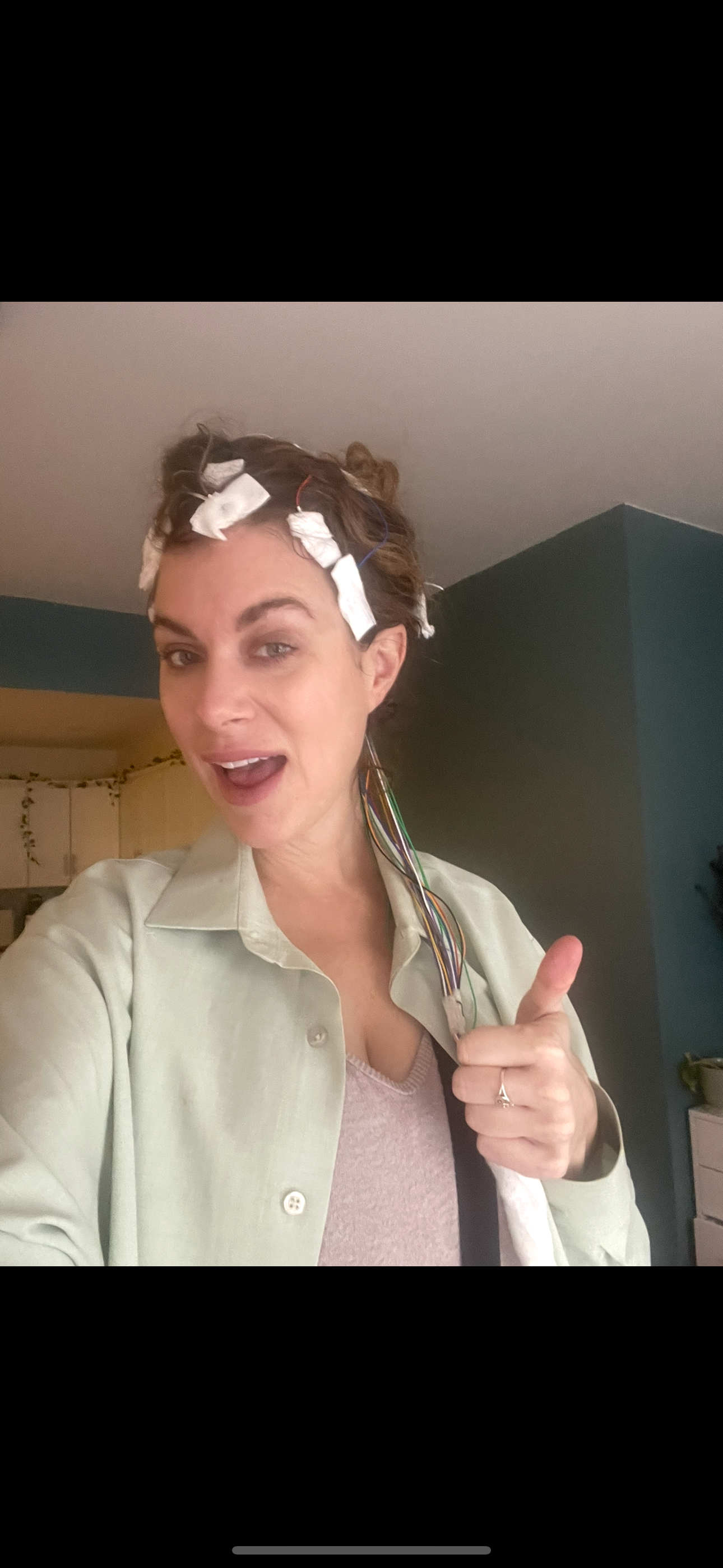 My medical journey & rescue pack desperately need support! campaign photo, 2 of 7