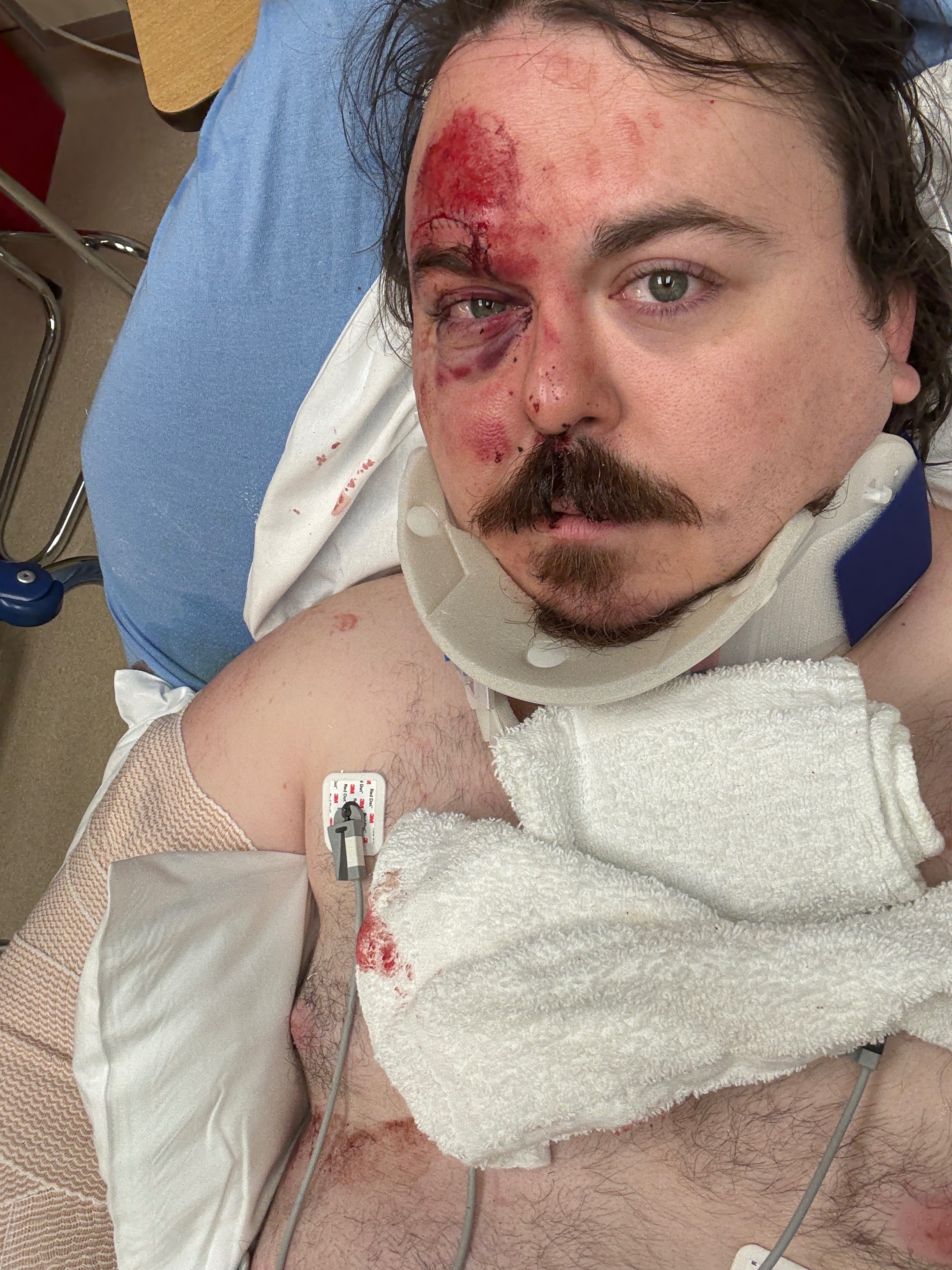 Help Me Heal and Rebuild campaign photo, 2 of 7