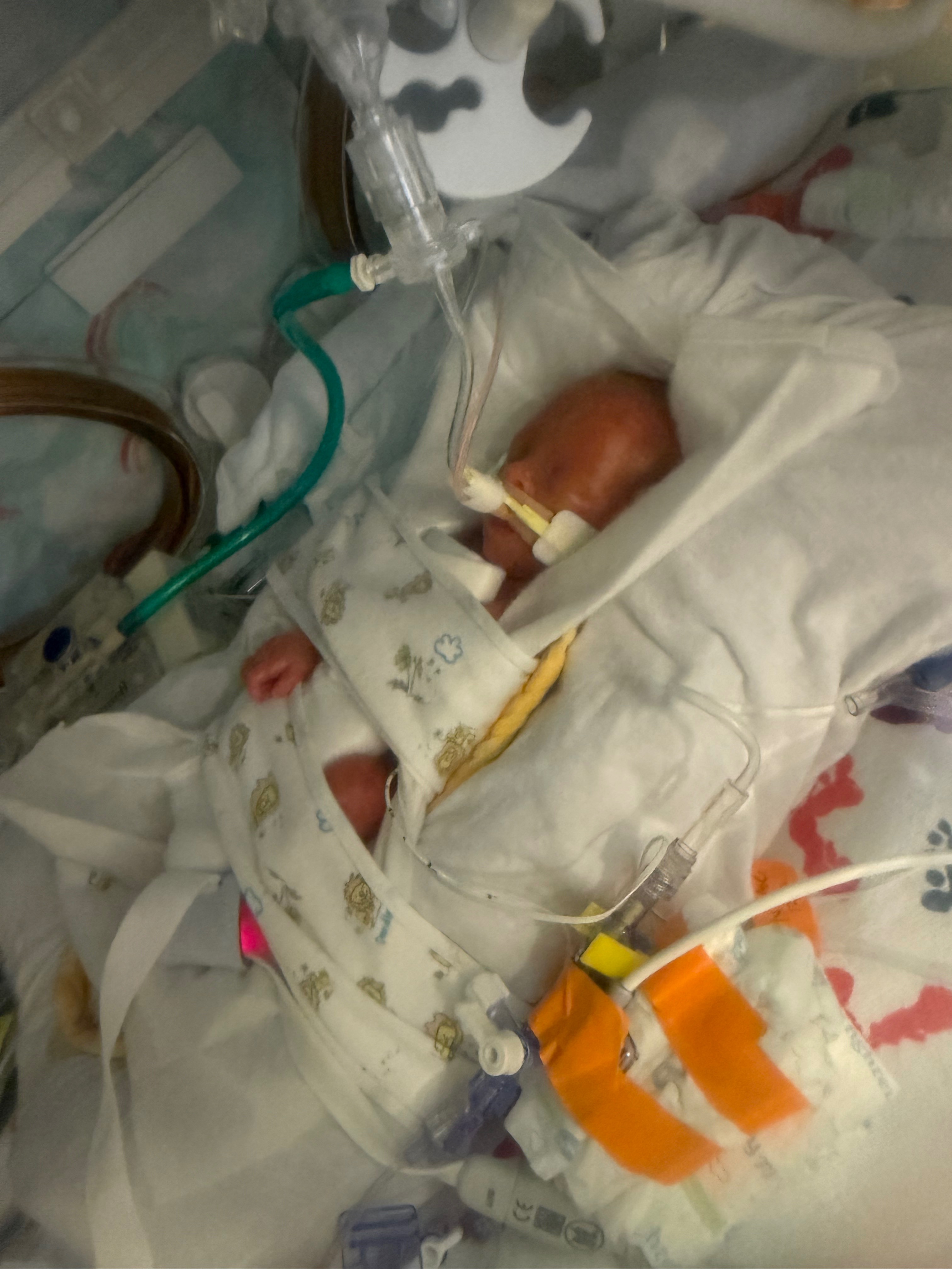 Care for the Wilson Family and Their Preemies campaign photo, 2 of 4