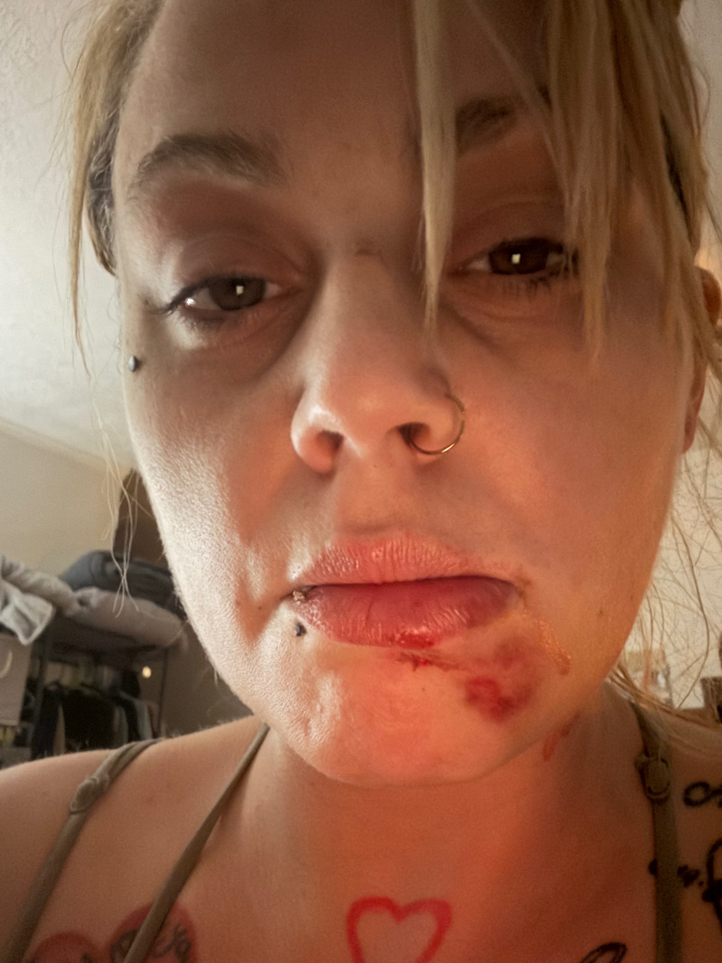 Help Lindsey & Ashley Recover After Car Accident campaign photo, 2 of 7