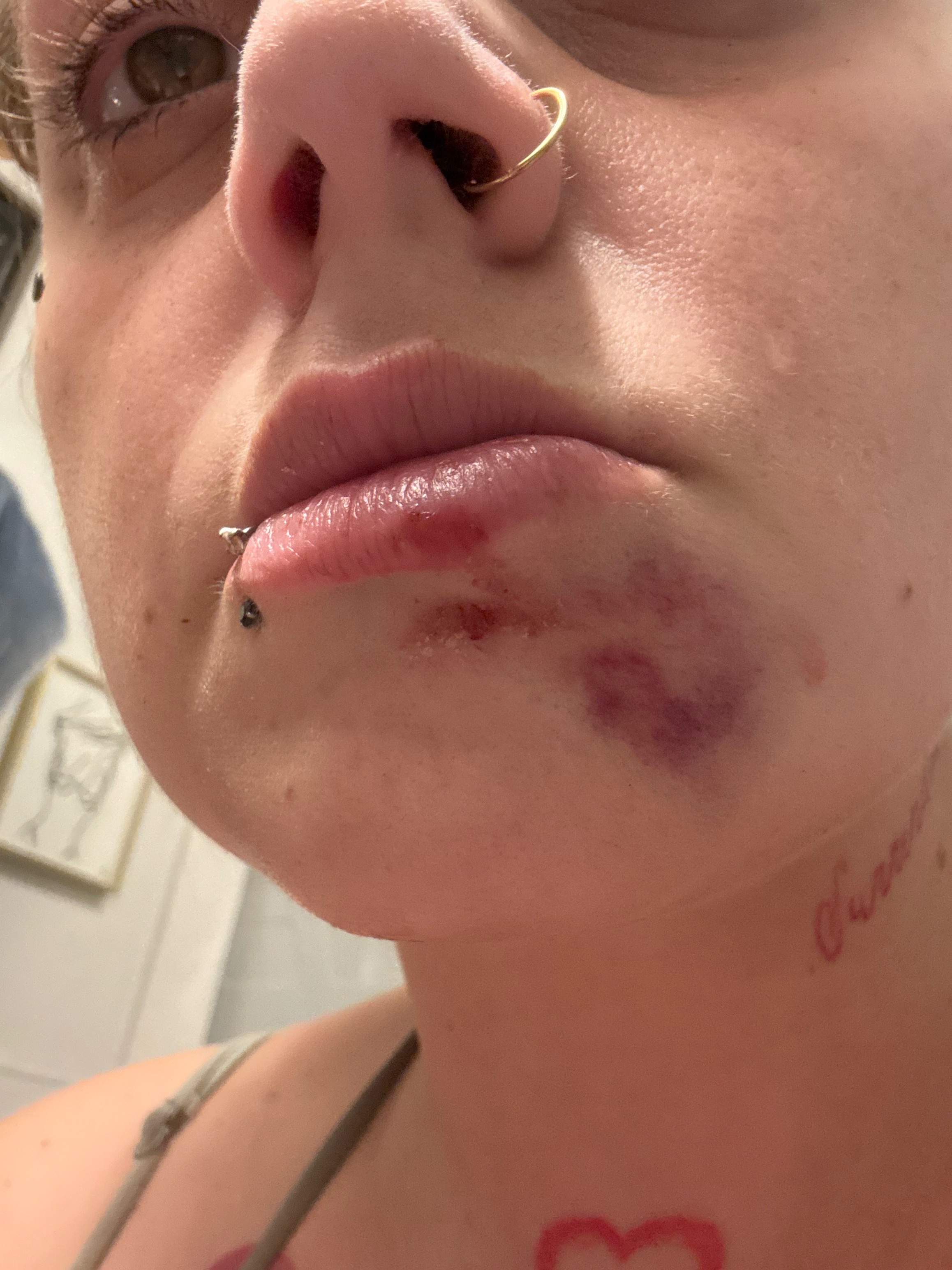 Help Lindsey & Ashley Recover After Car Accident campaign photo, 4 of 7