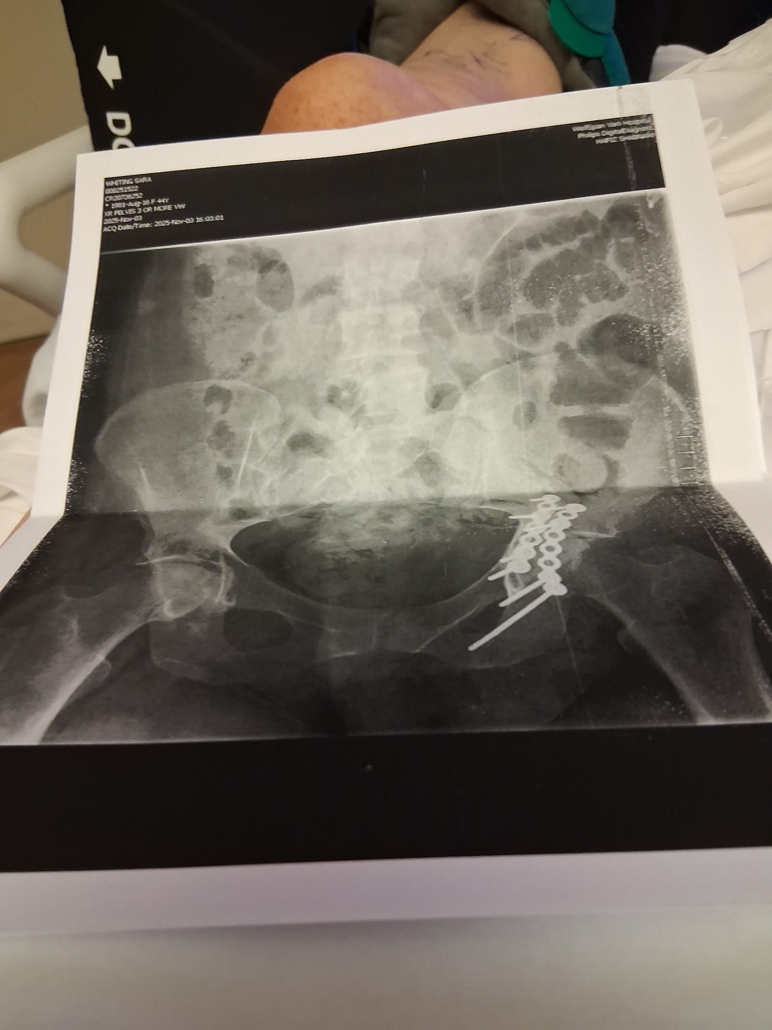 Support Sara Whiting’s Recovery After Accident campaign photo, 4 of 8