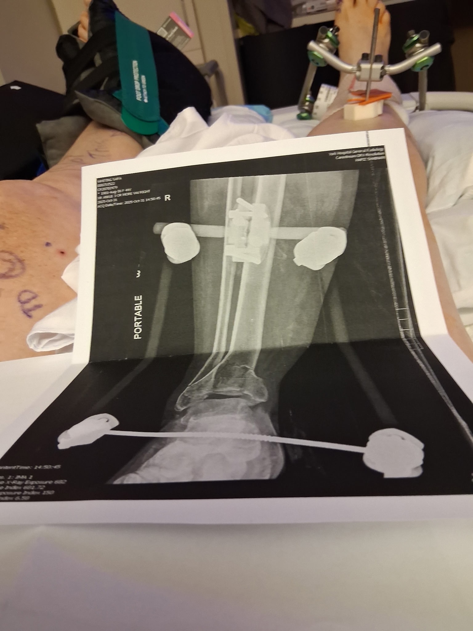 Support Sara Whiting’s Recovery After Accident campaign photo, 2 of 8