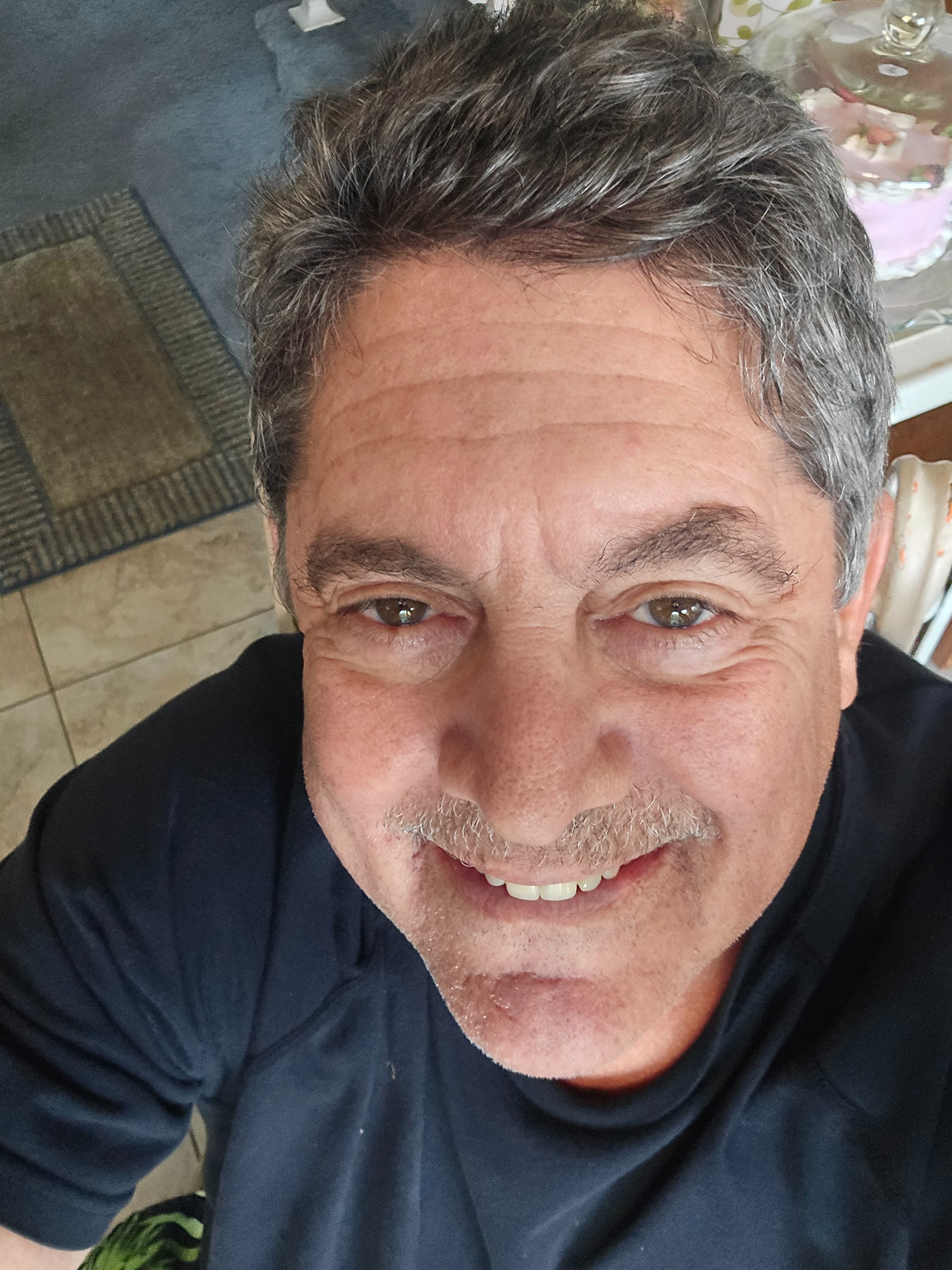 Help Bryan Dance Again: Hip & Knee Surgery campaign photo, 6 of 8