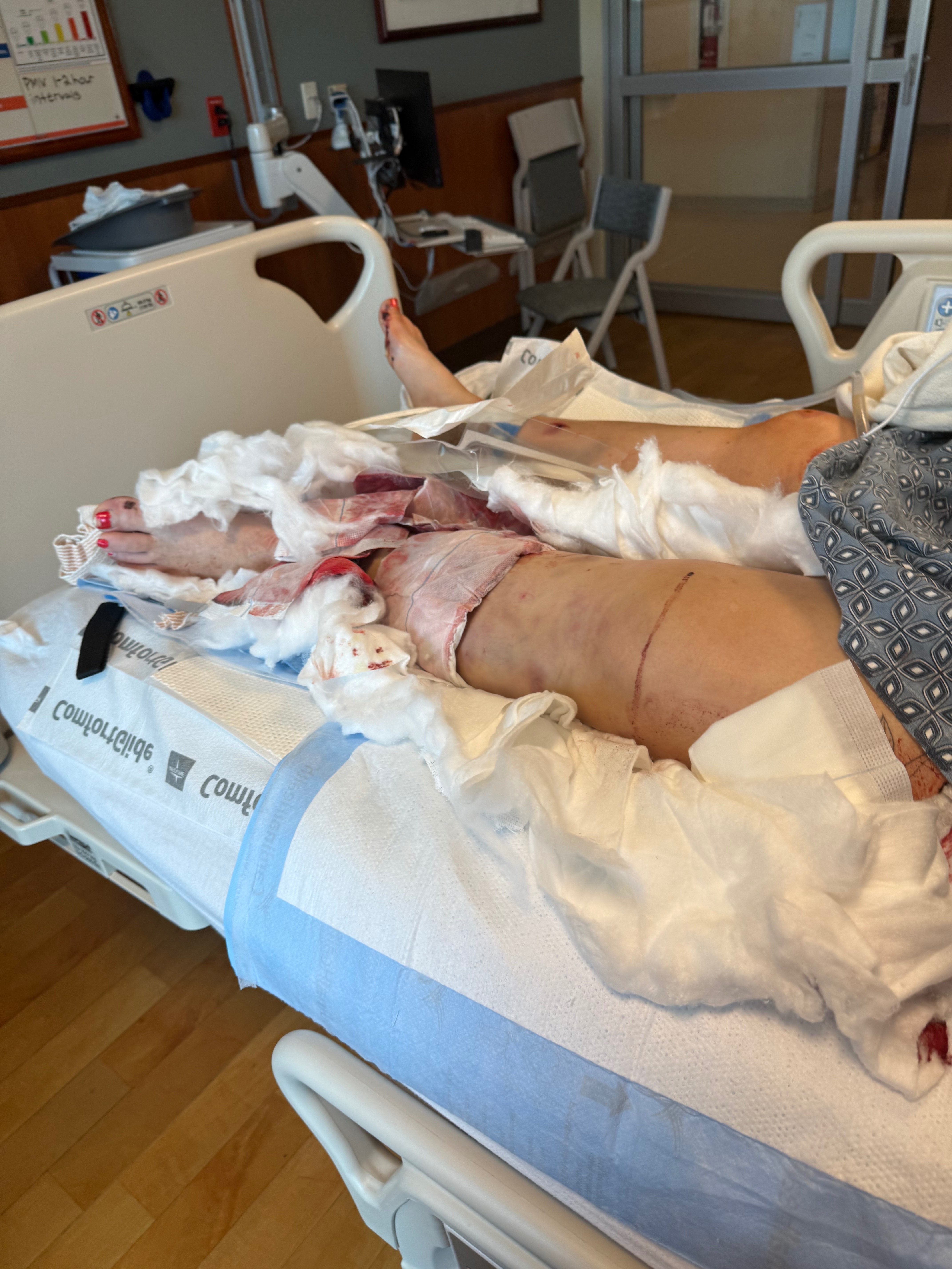 Support for a Mother’s Fight After Motorcycle Accident campaign photo, 6 of 7