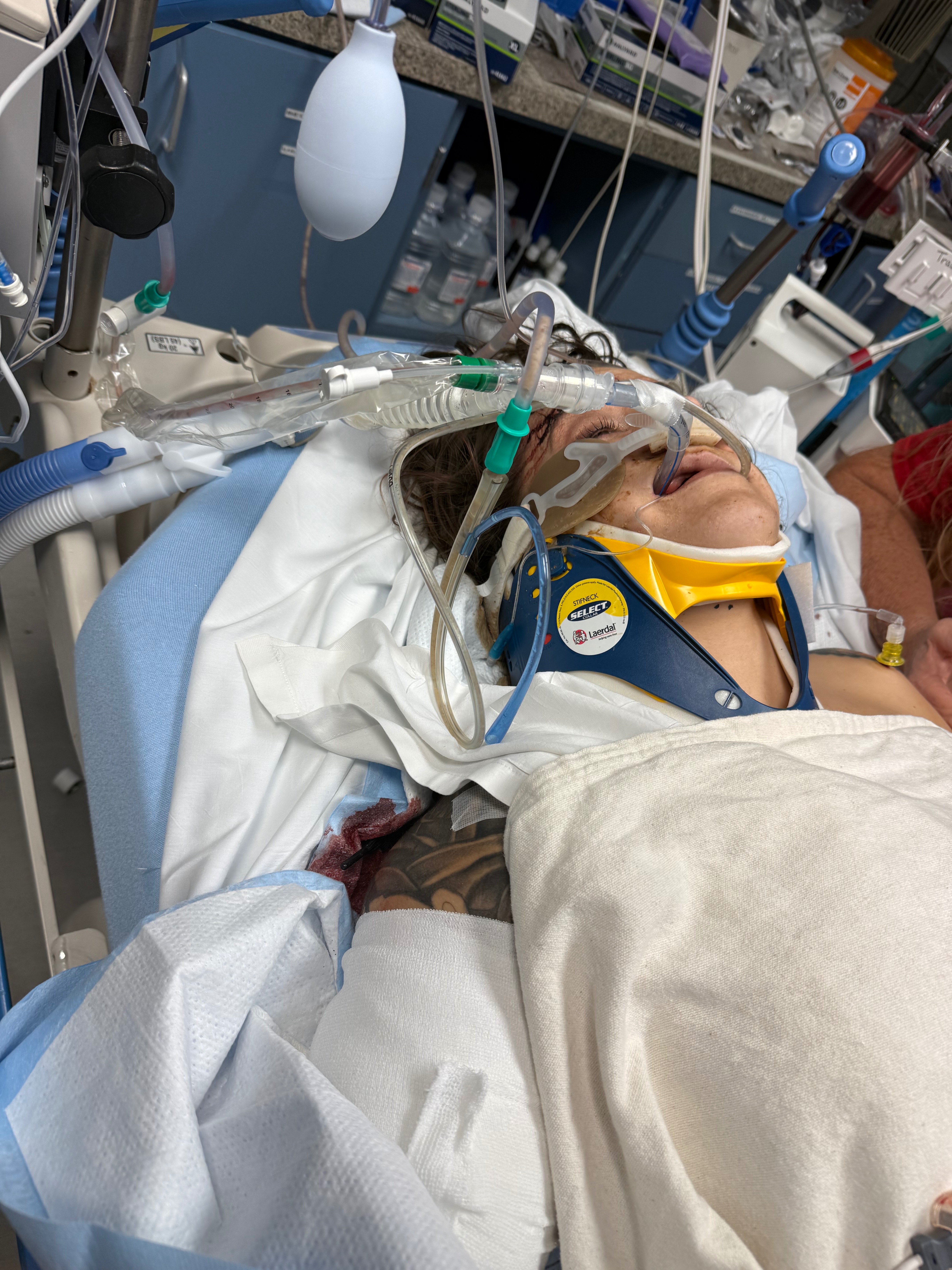 Support for a Mother’s Fight After Motorcycle Accident campaign photo, 2 of 7