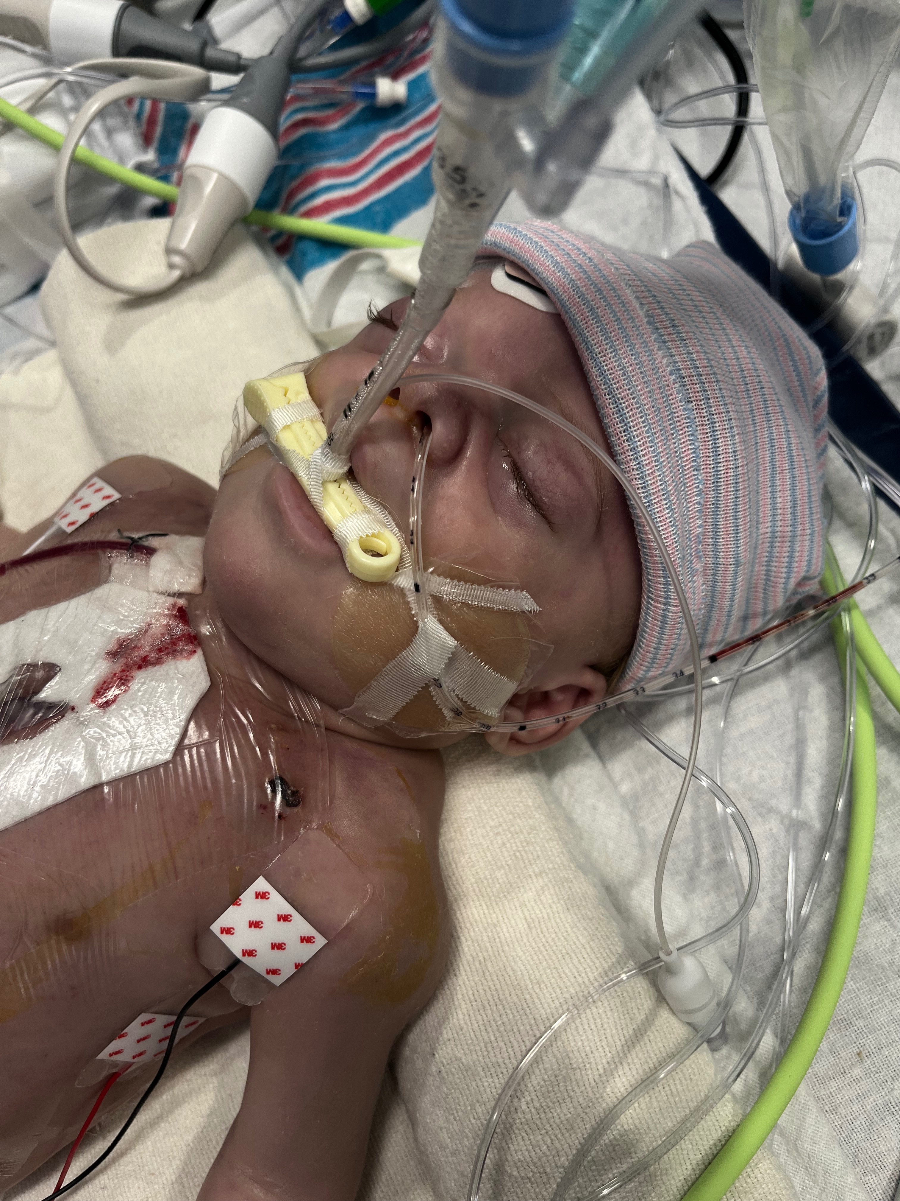 Support Elijah’s Heart Surgery and Jay’s Education campaign photo, 6 of 8