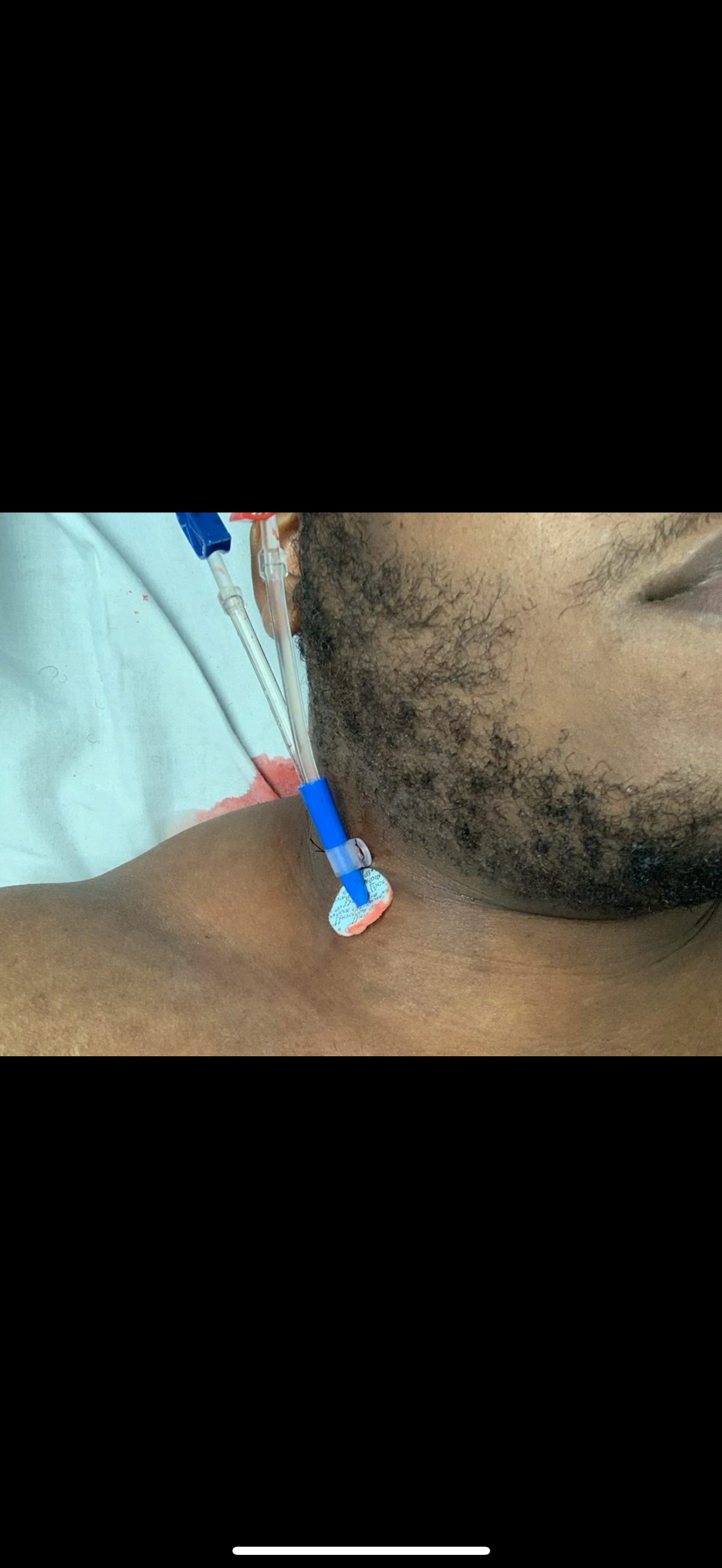 Father Fighting Kidney Failure trying to Support His Autisti campaign photo, 4 of 8