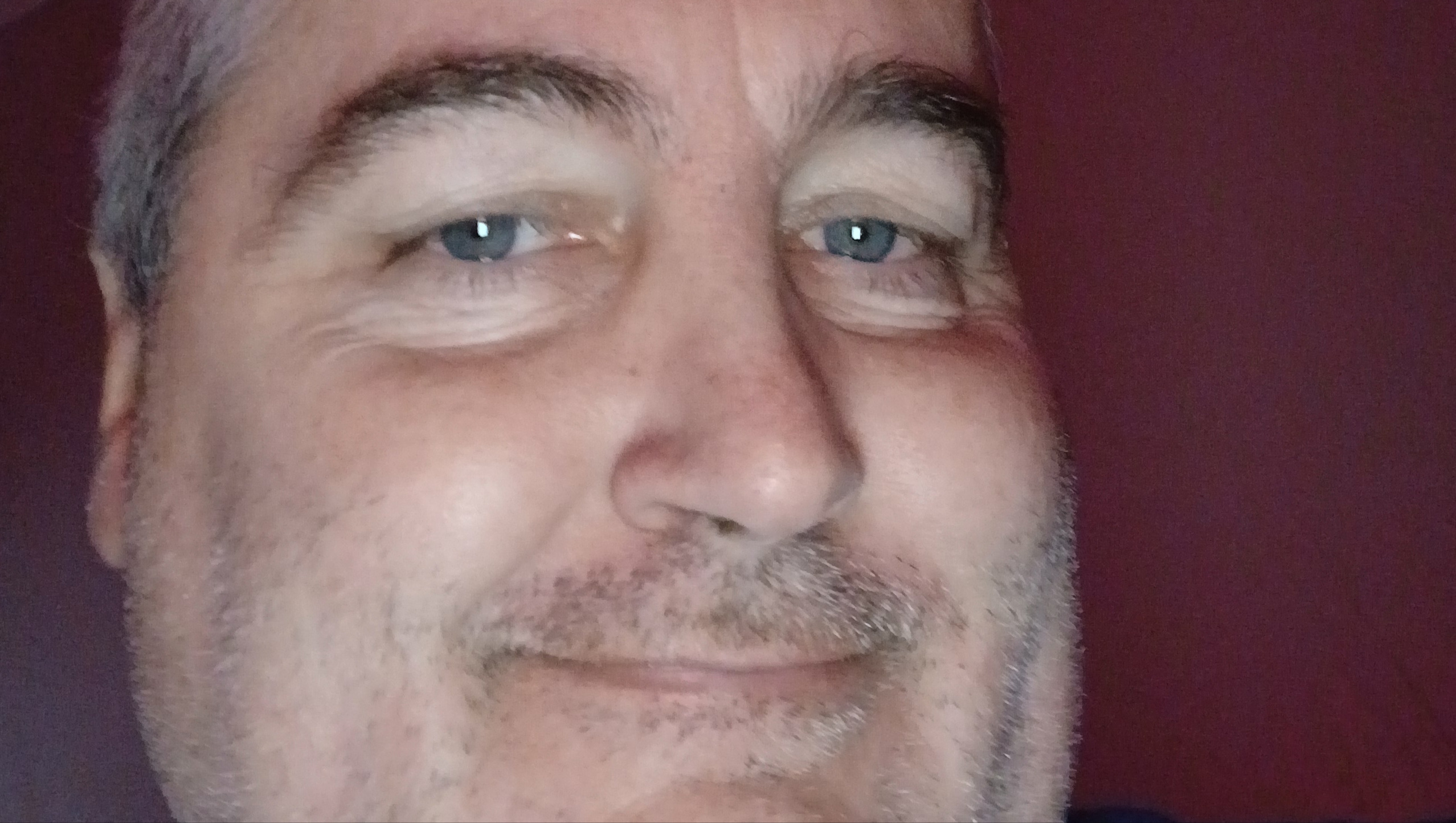 Help Timothy Get a Scooter & Clothes photo