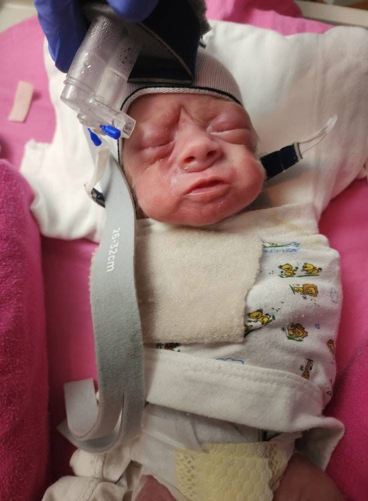Prayers for Healing for Baby Hadley Sue campaign photo, 2 of 7