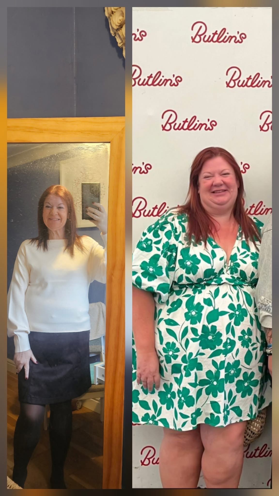 13 stone lost, need loose skin removed!! campaign photo, 6 of 7