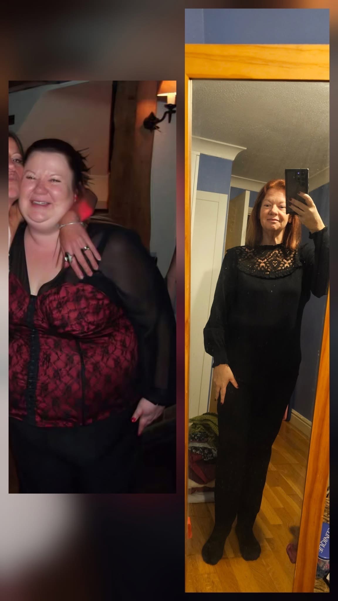 13 stone lost, need loose skin removed!! campaign photo, 2 of 7