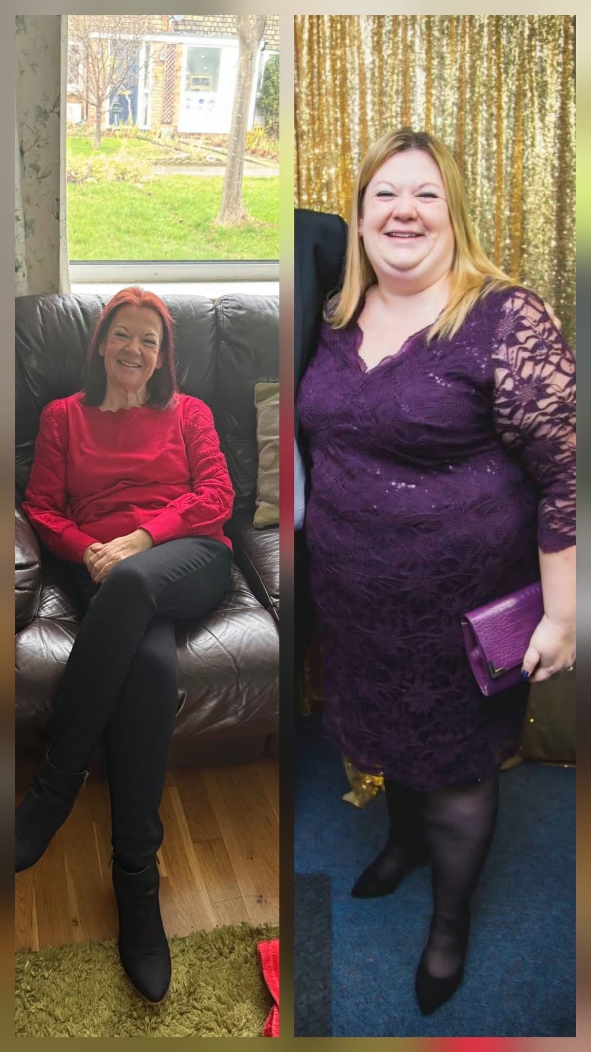 13 stone lost, need loose skin removed!! campaign photo, 4 of 7
