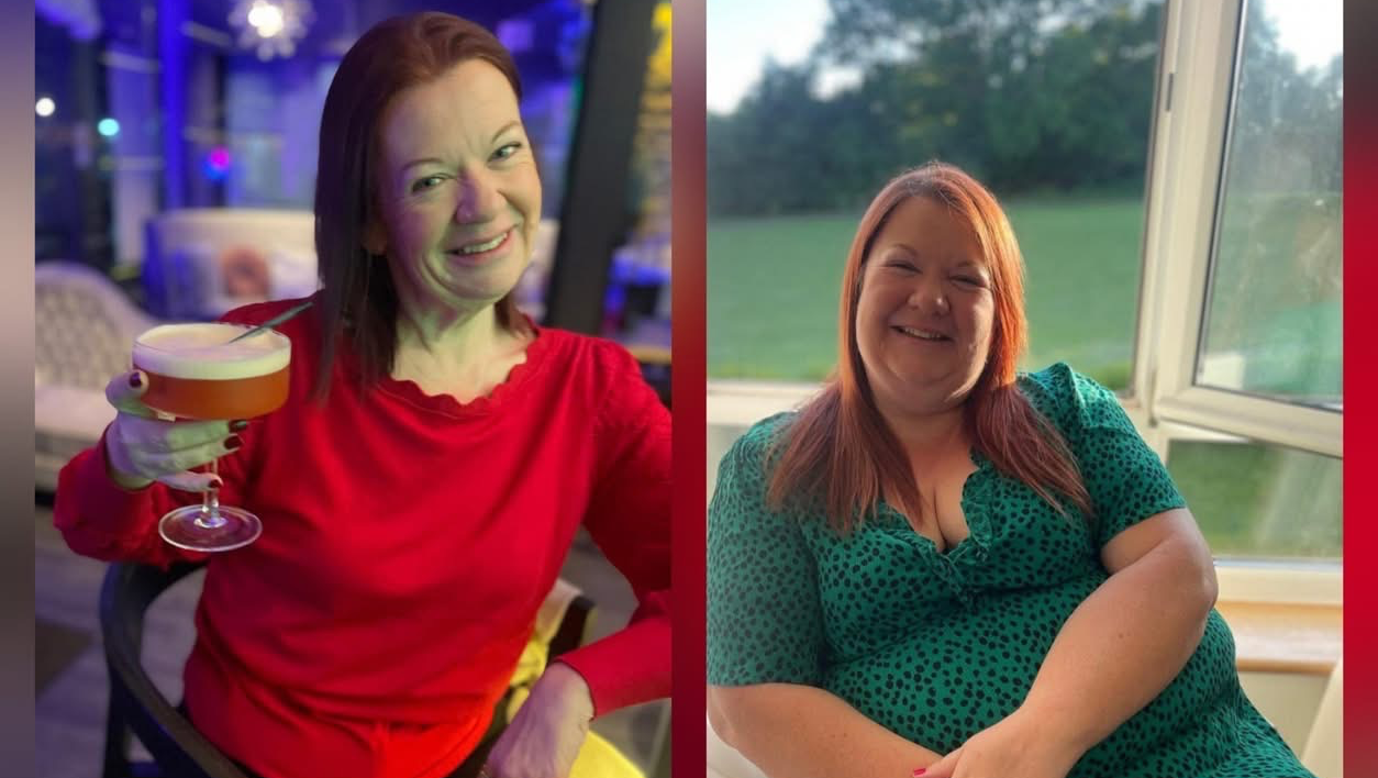 13 stone lost, need loose skin removed!! campaign photo, 5 of 7