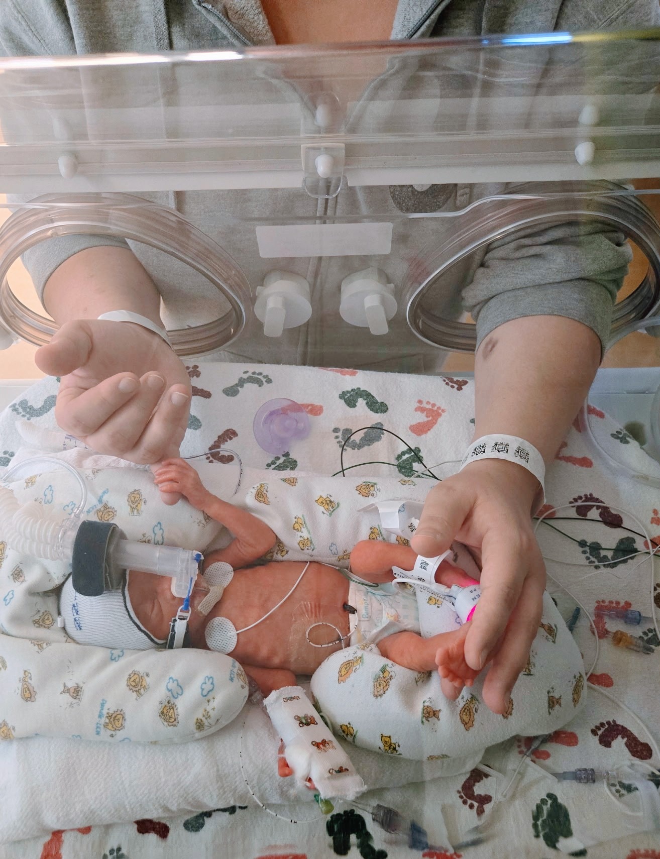 Support Baby Lonnie’s NICU Journey campaign photo, 6 of 7