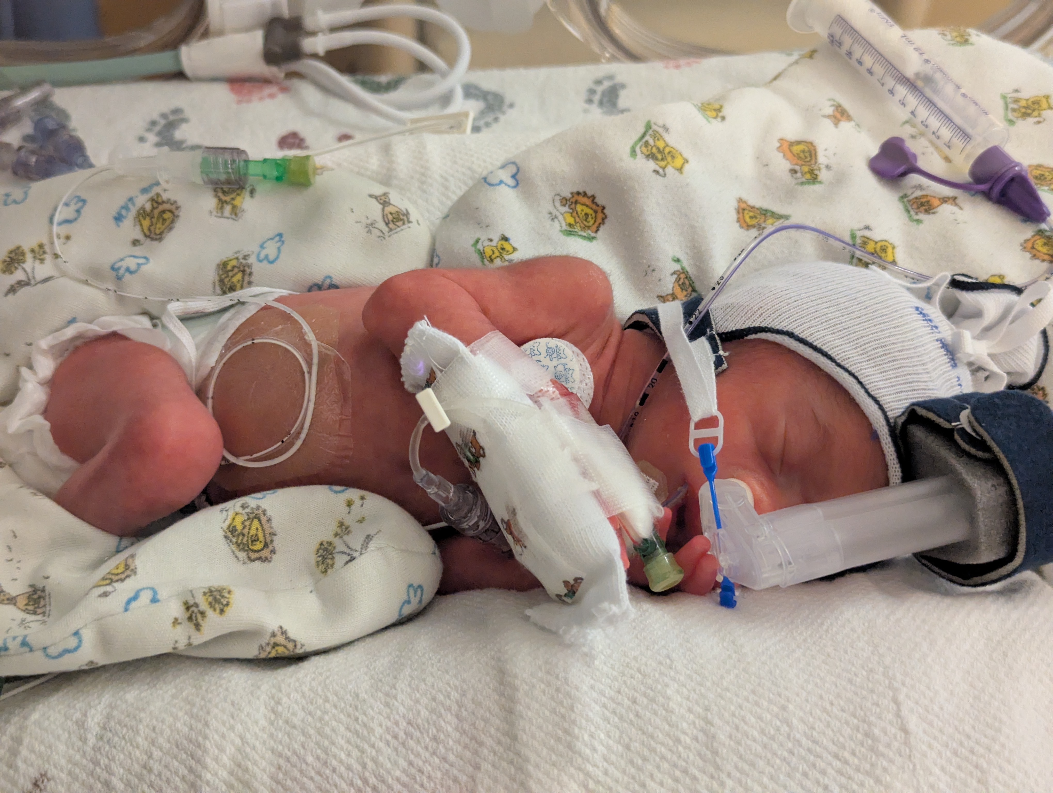 Support Baby Lonnie’s NICU Journey campaign photo, 2 of 7