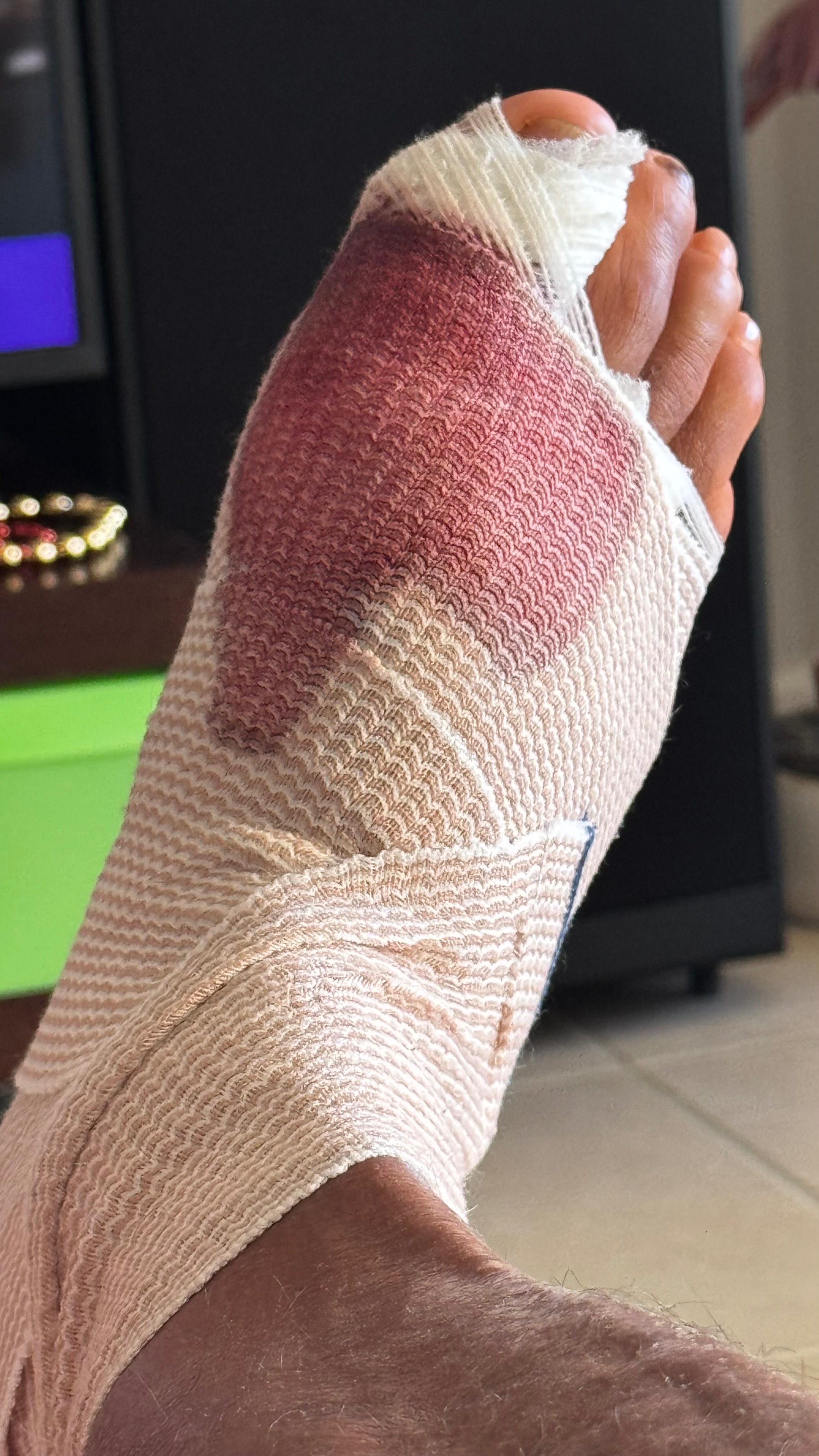 Support Steven’s Recovery After Surgery campaign photo, 4 of 5