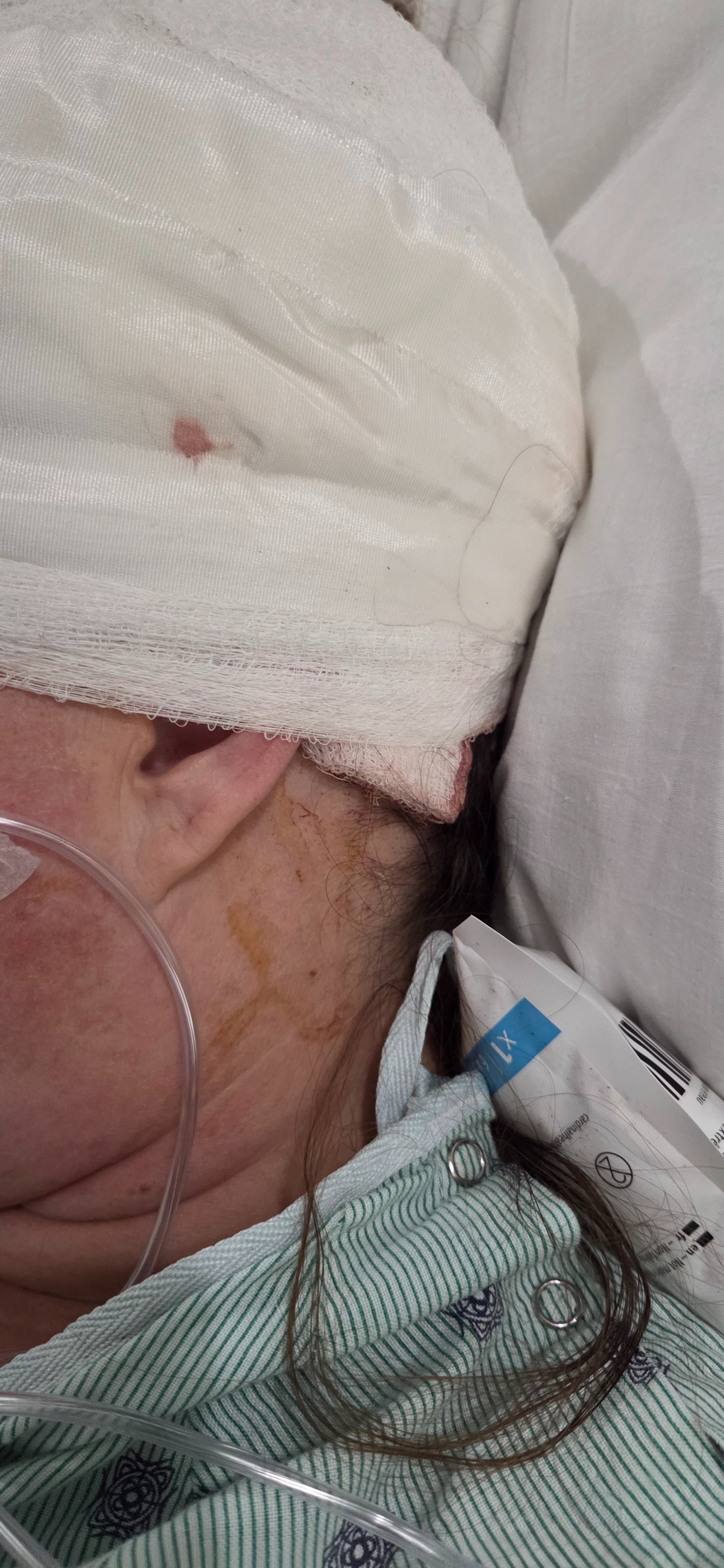 Support Dee’s Recovery After Brain Surgery campaign photo, 7 of 8