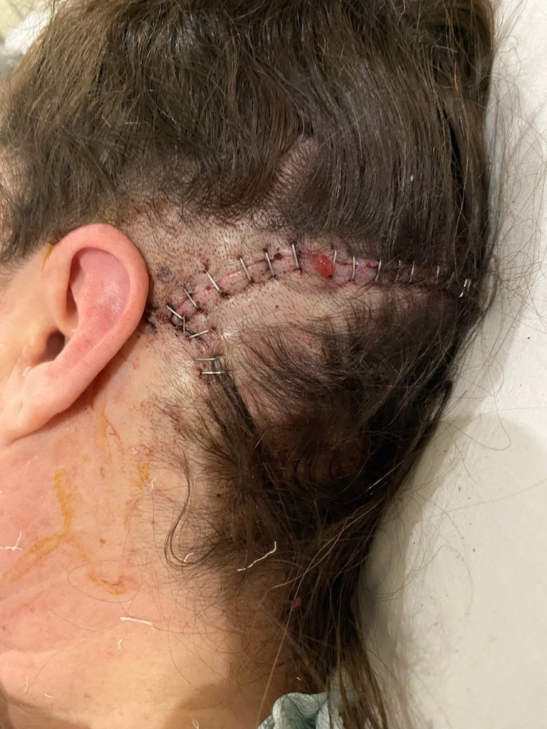 Support Dee’s Recovery After Brain Surgery campaign photo, 4 of 8