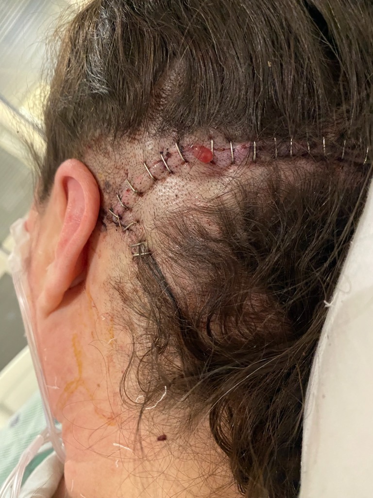 Support Dee’s Recovery After Brain Surgery campaign photo, 5 of 8