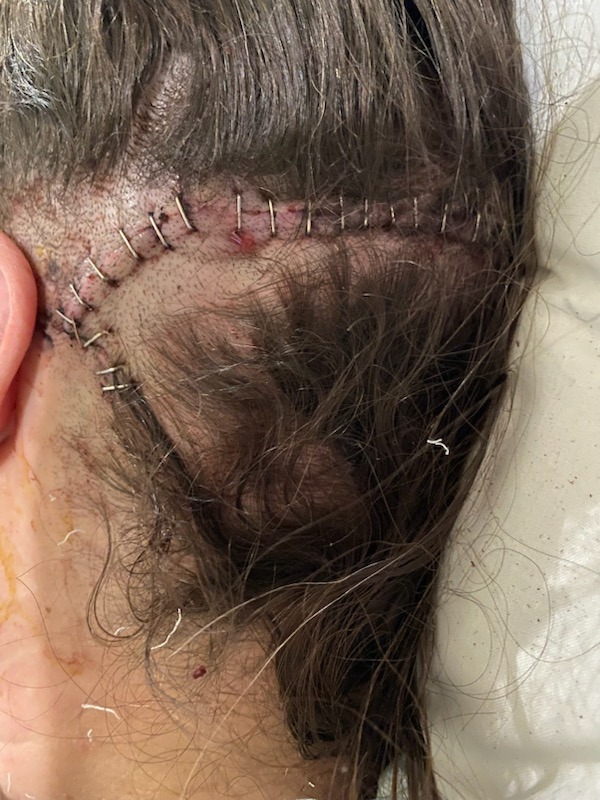 Support Dee’s Recovery After Brain Surgery campaign photo, 6 of 8