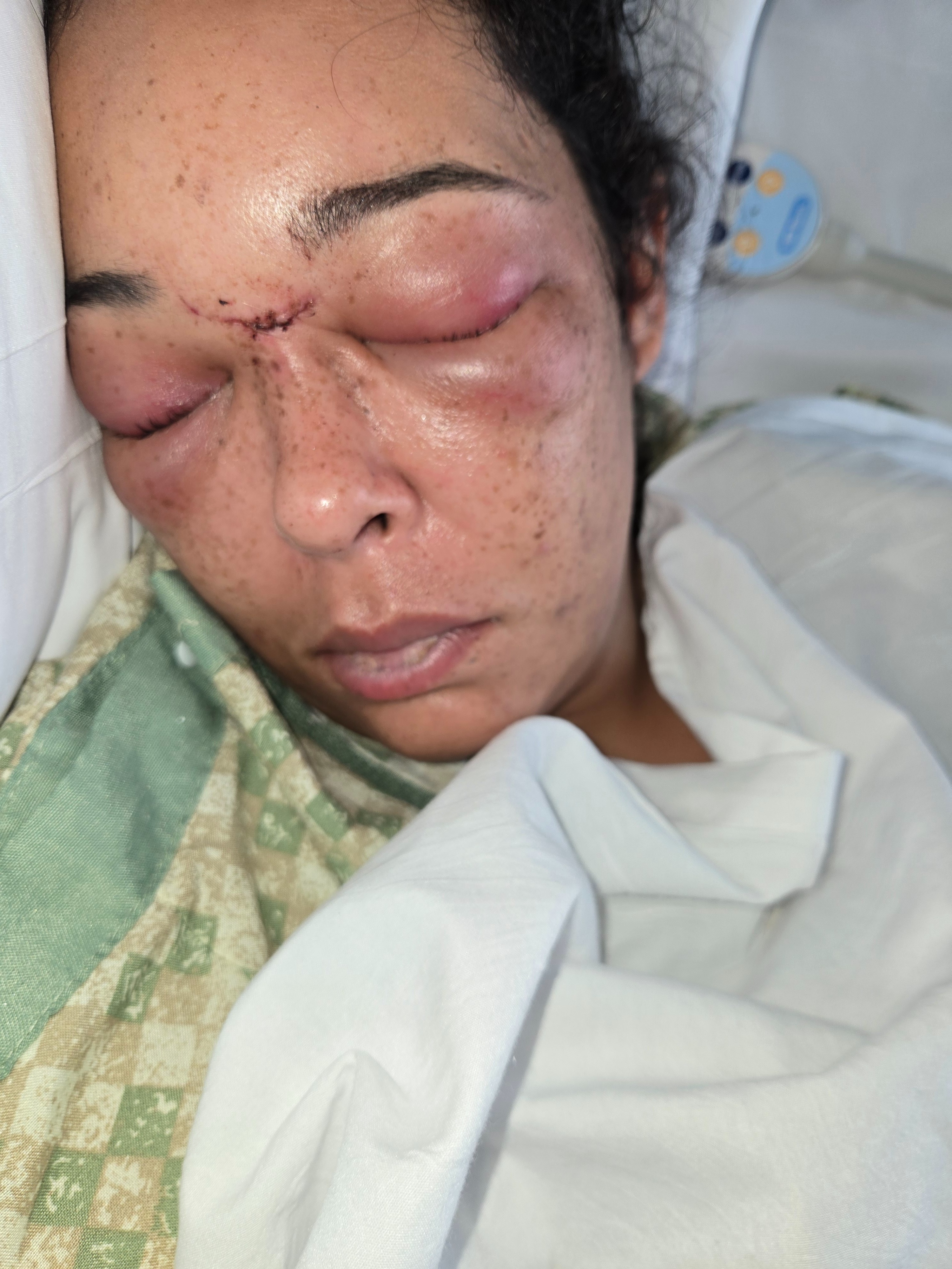 Support for Melissa's Daughter's Surgery and Recovery campaign photo, 2 of 4