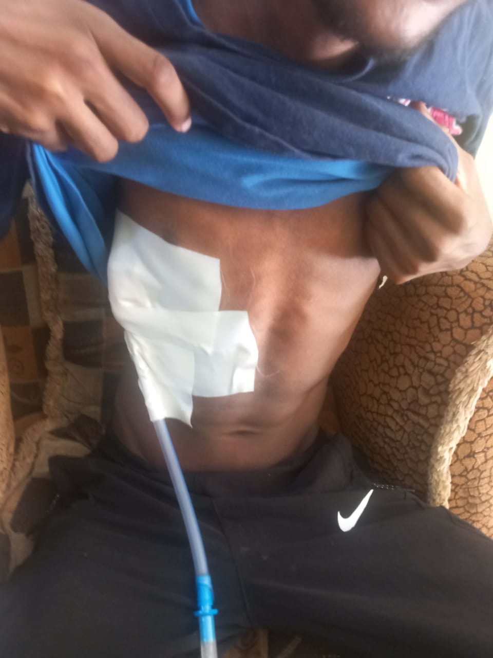 Cancer & TB Threaten Ahmed... Will We Wait Until It's Too La campaign photo, 4 of 8