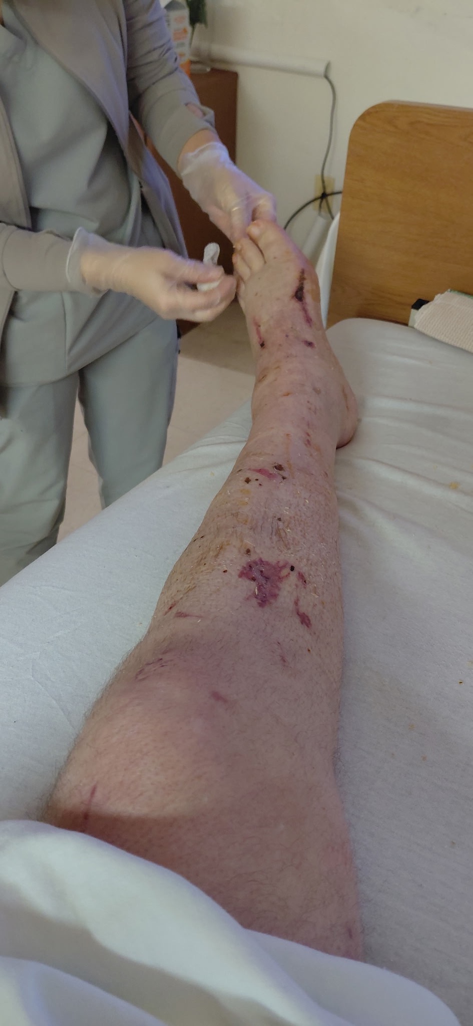 Help Noah Long Get Back on His Feet campaign photo, 2 of 4