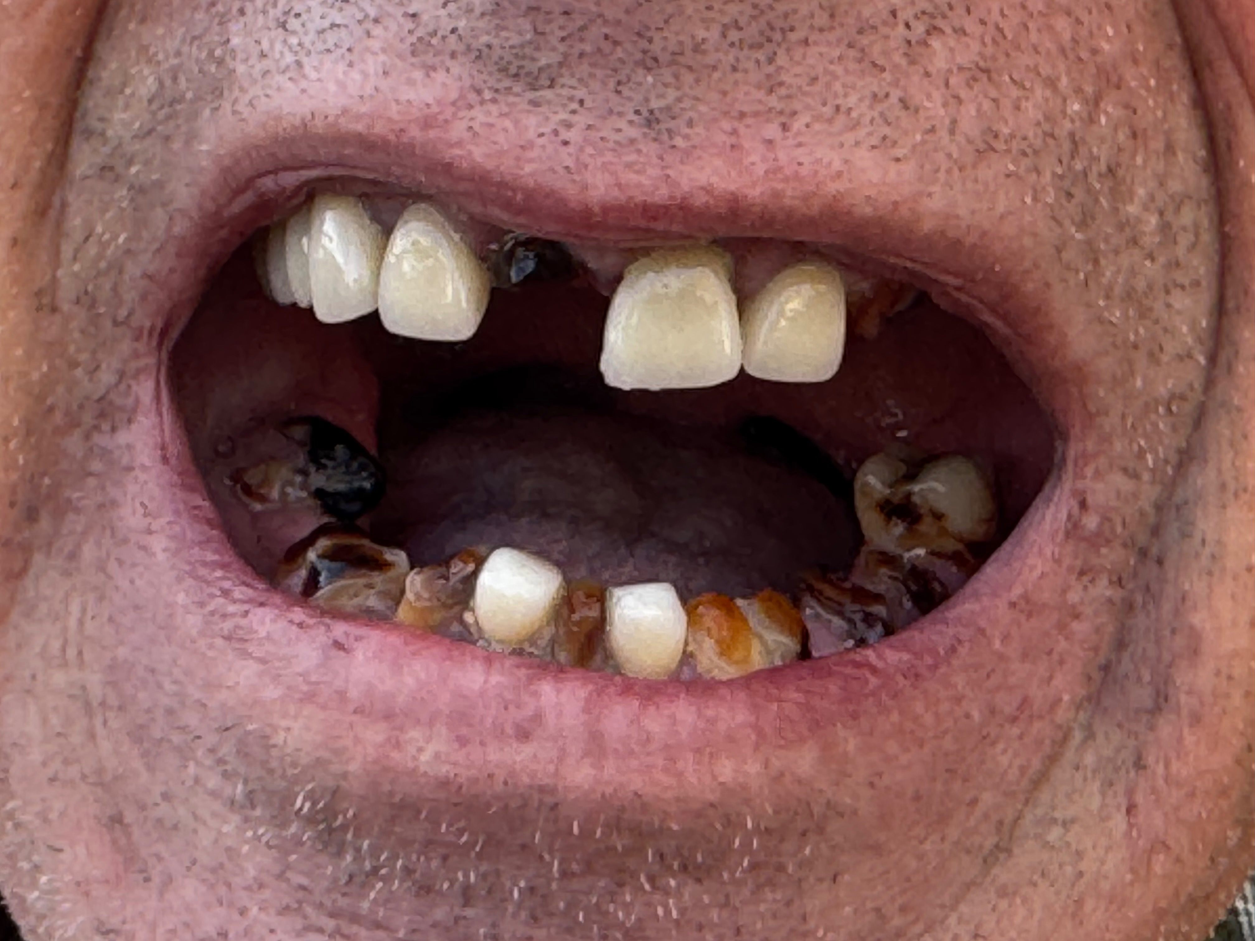 Help David J. DeStafeno Smile Again campaign photo, 7 of 8