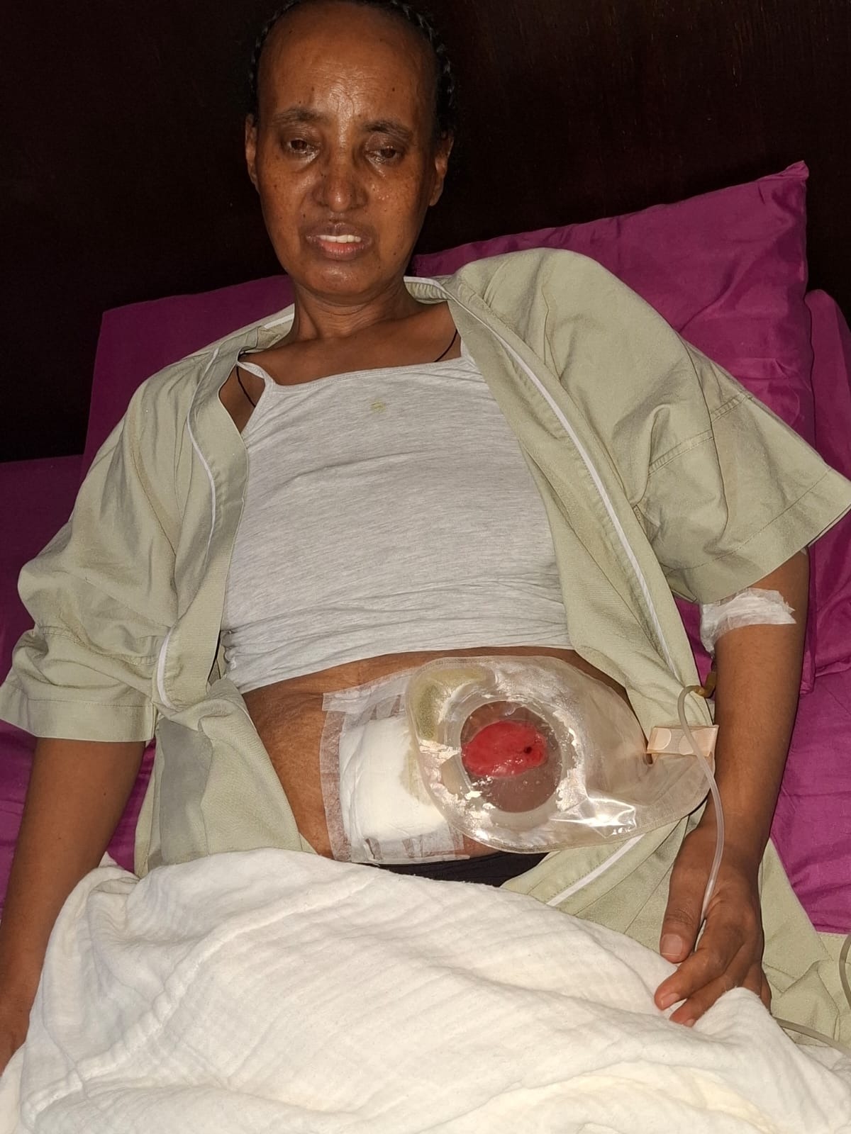 Urgent Appeal: Save an Eritrean Mother Battling Cancer campaign photo, 2 of 6