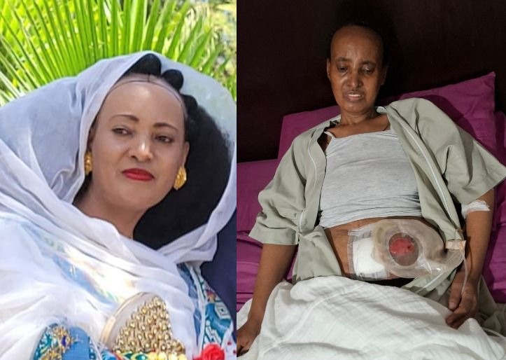 Urgent Appeal: Save an Eritrean Mother Battling Cancer campaign photo, 4 of 6