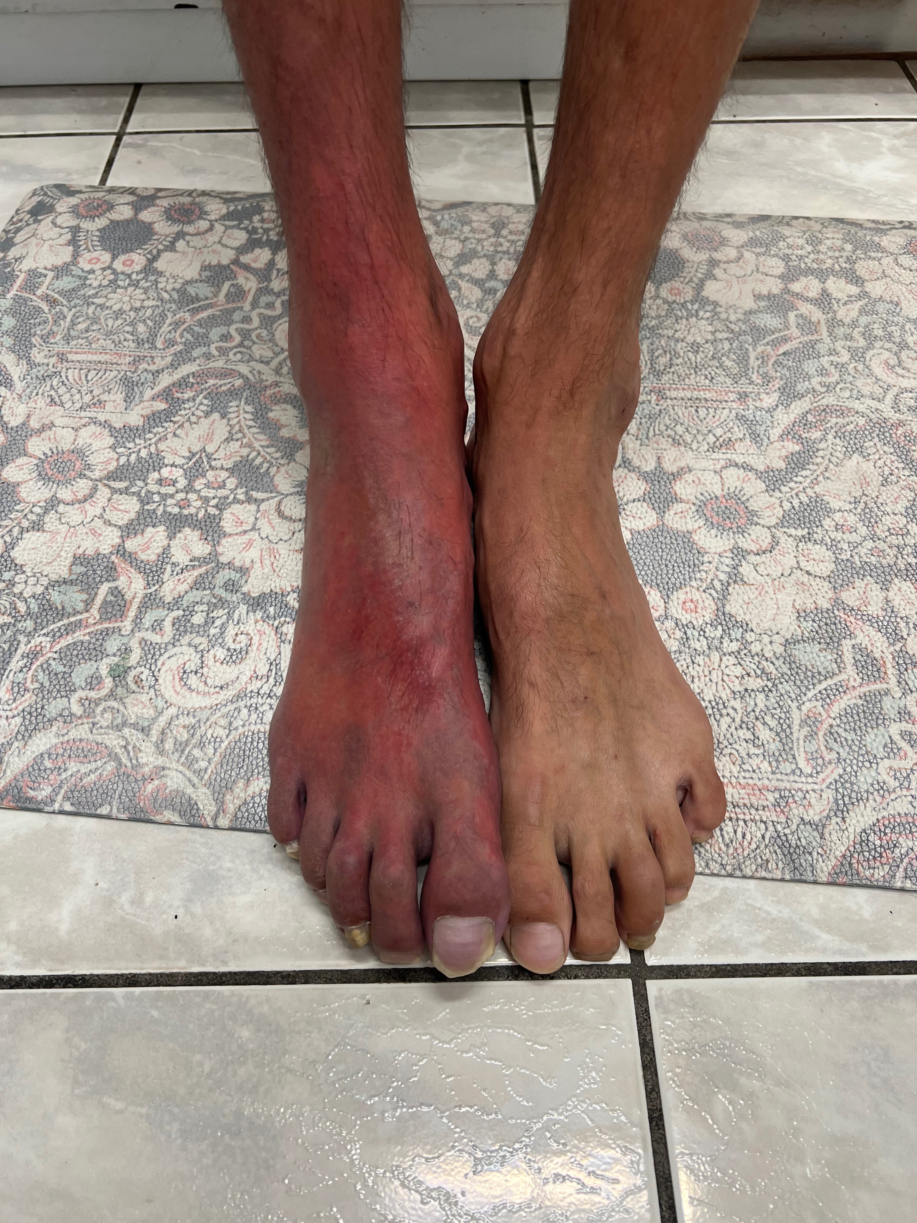 Help Tree Walk Again After RSD Diagnosis campaign photo, 5 of 6