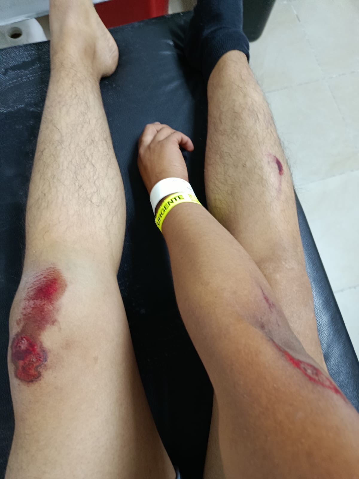 Help Emilio Cordova Get Urgent Surgery campaign photo, 5 of 6