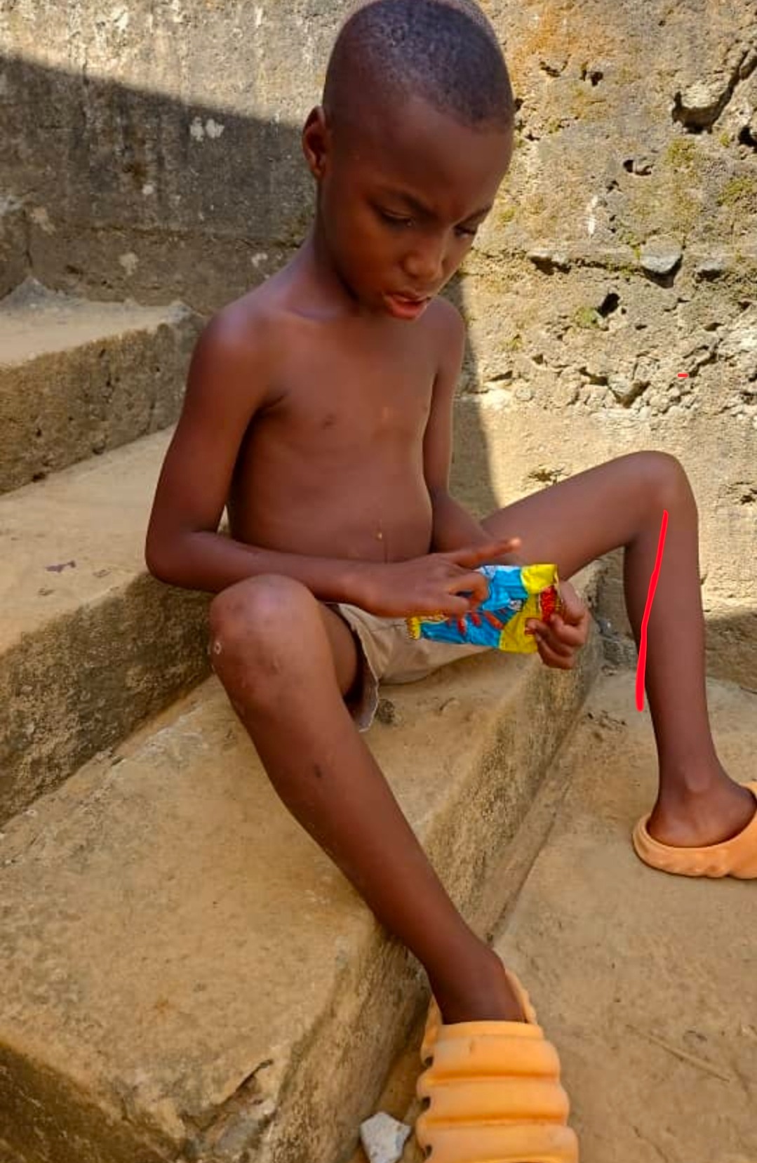 Trachoma risk campaign photo, 4 of 8