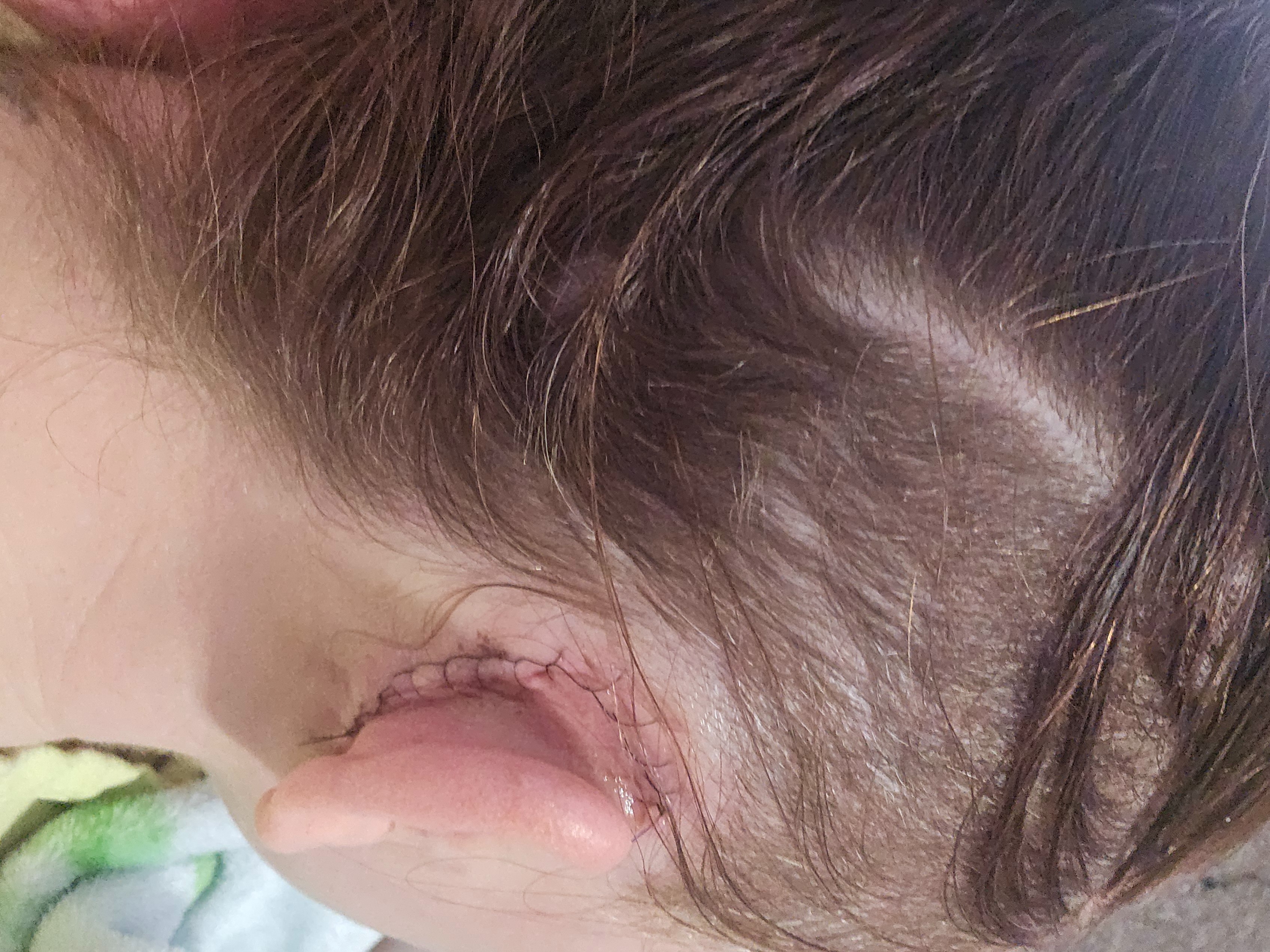 Support Brittany’s Journey to Better Hearing campaign photo, 4 of 8