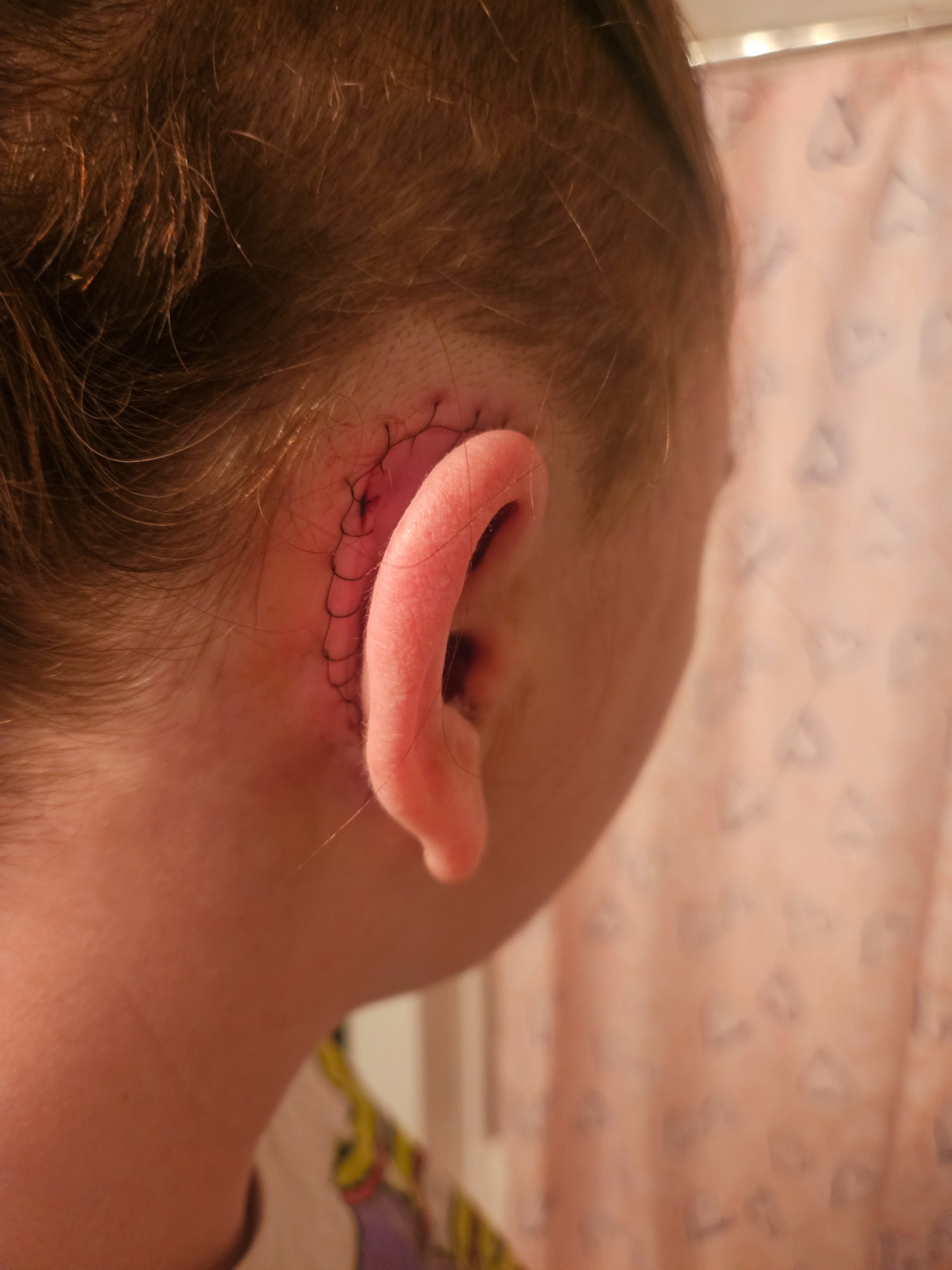 Support Brittany’s Journey to Better Hearing campaign photo, 5 of 8