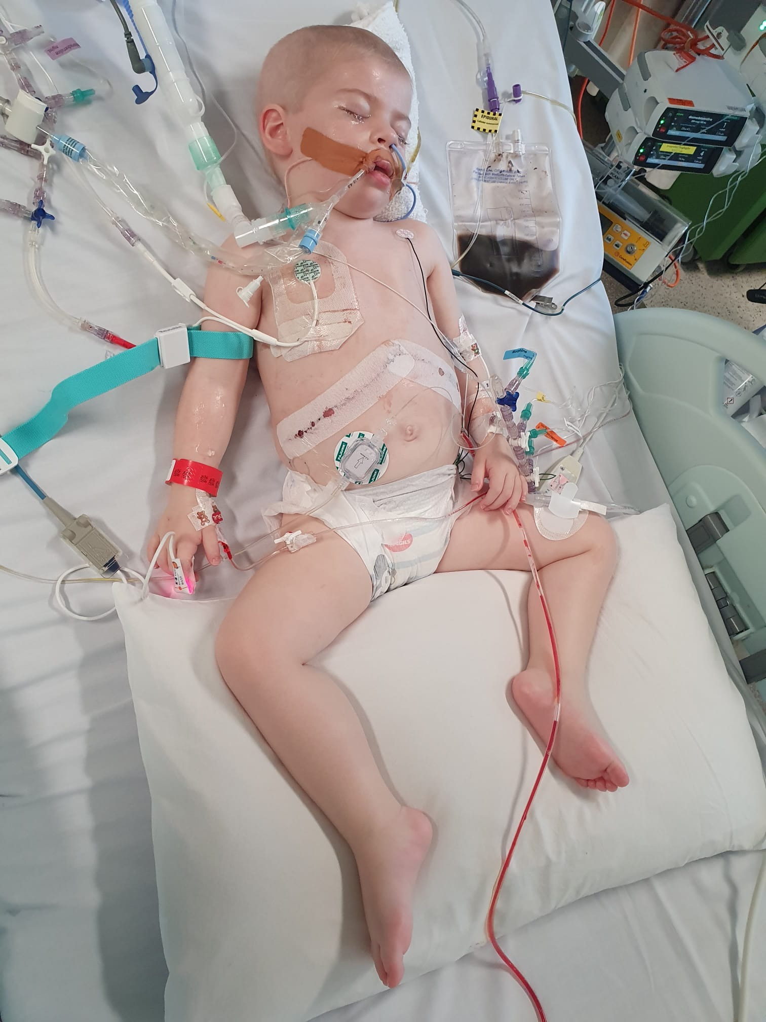 Support Willow’s Fight Against Mucormycosis & Leukaemia campaign photo, 4 of 8