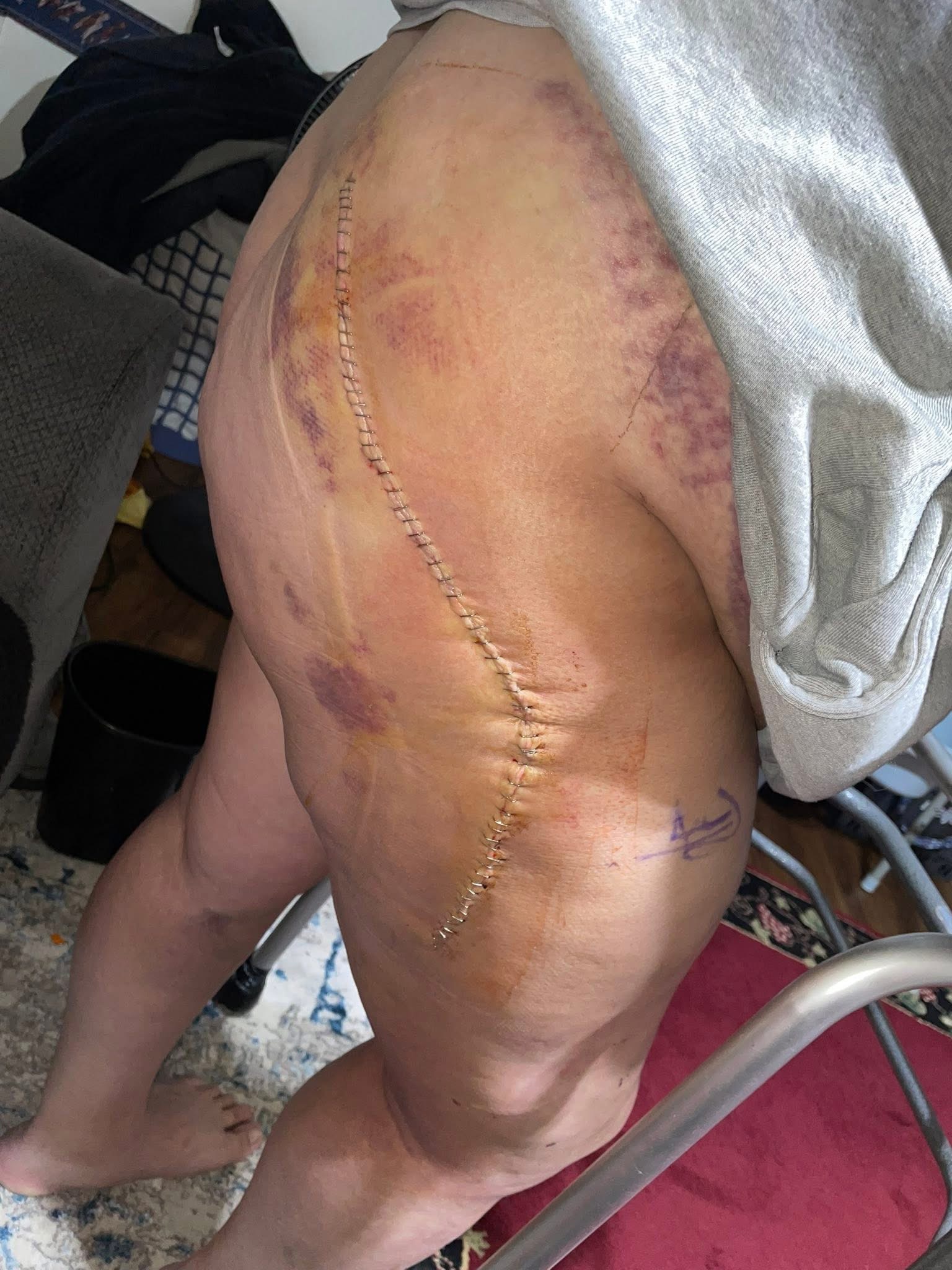 Support Juju's Recovery After Car Accident campaign photo, 7 of 8