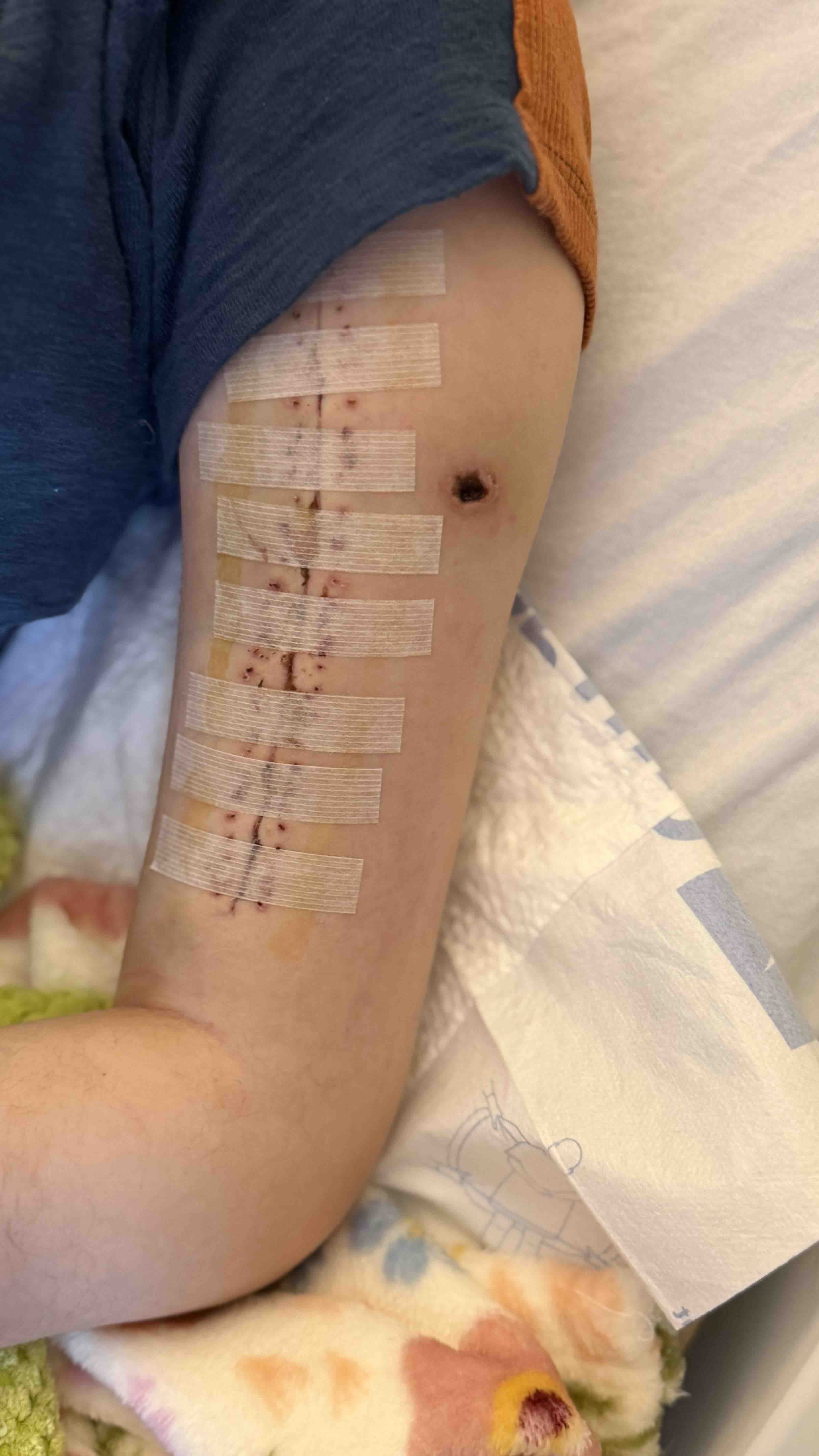 Help my 18 y.o pregnant child after she was shot campaign photo, 2 of 5