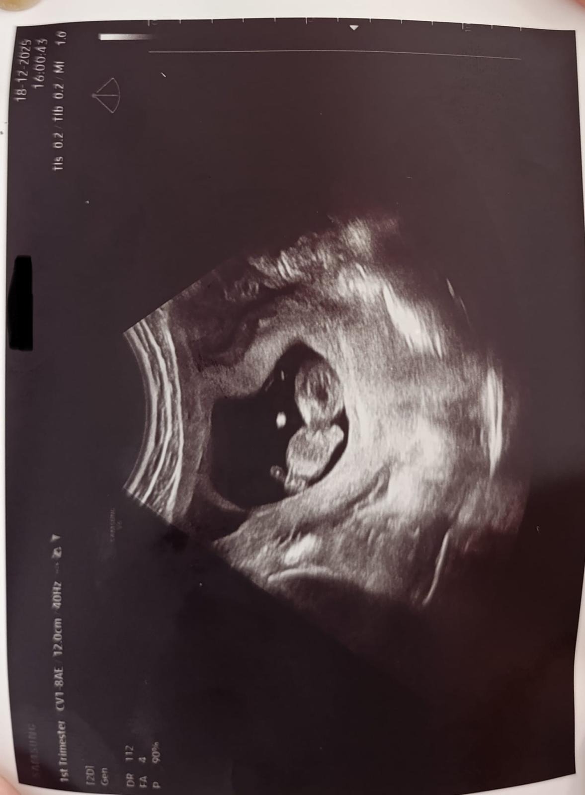 Help an Asylum Seeking Mother Access Urgent Prenatal Care campaign photo, 7 of 8