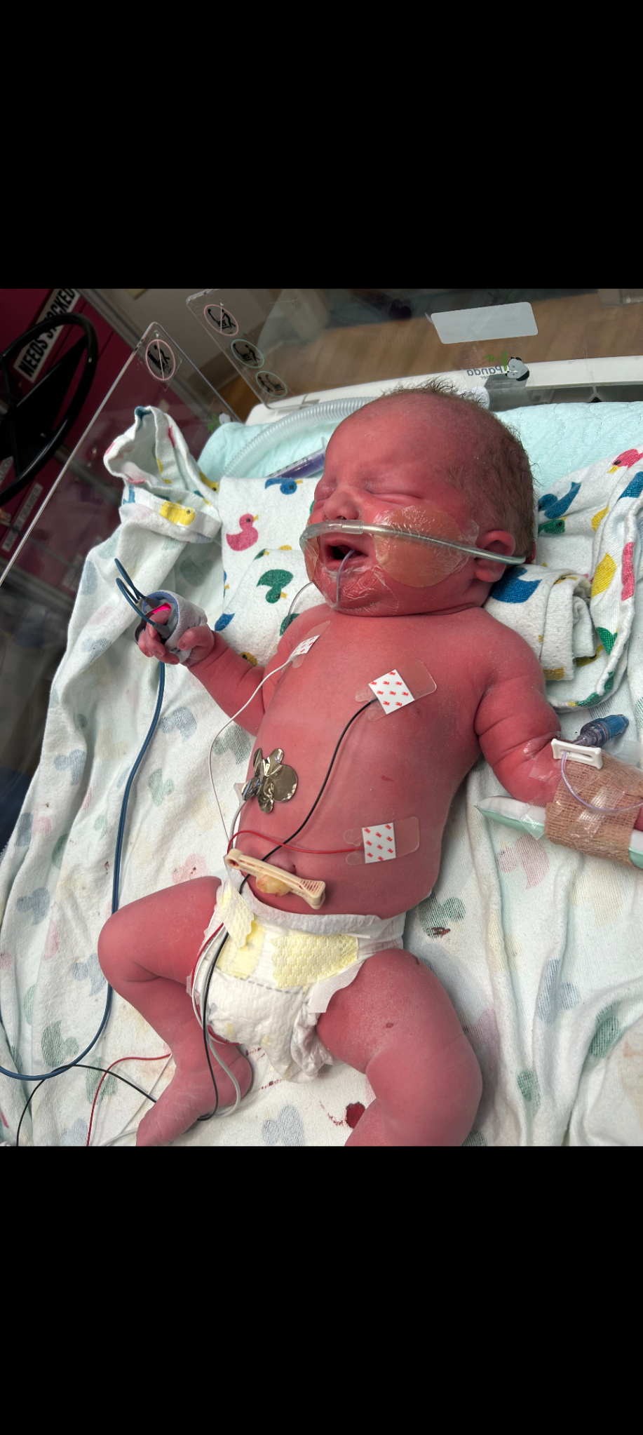 Support Haley & Michael's NICU Journey campaign photo, 5 of 7