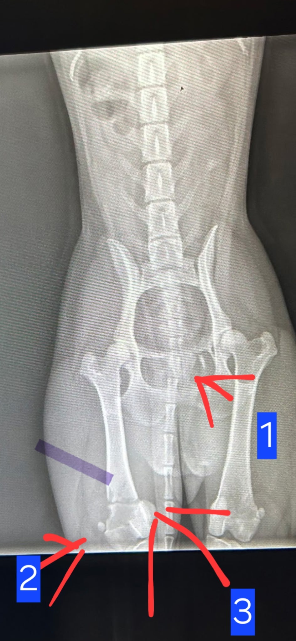 Help Florian Walk Again with Urgent Surgery campaign photo, 5 of 8