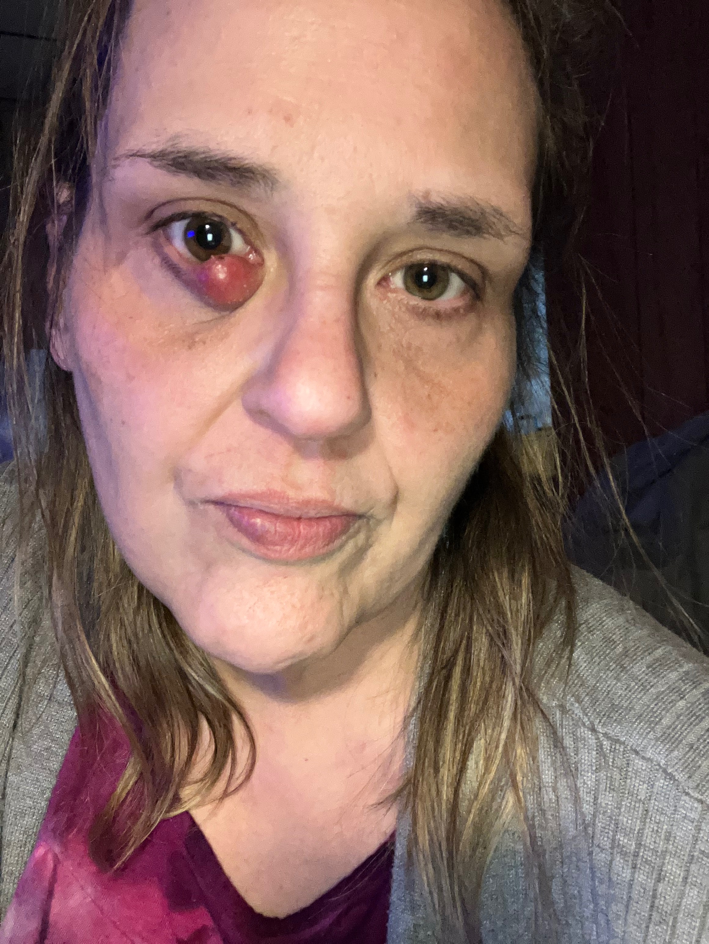 Standing with Me Through Surgery and Recovery campaign photo, 2 of 5