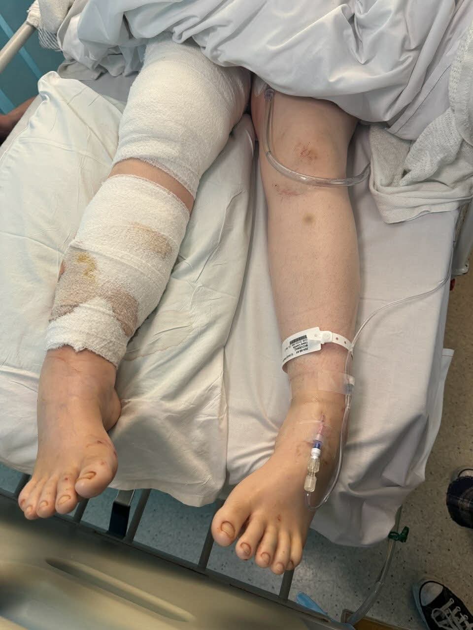 “Help Casey Heal After a Traumatic Dog Attack” campaign photo, 2 of 6