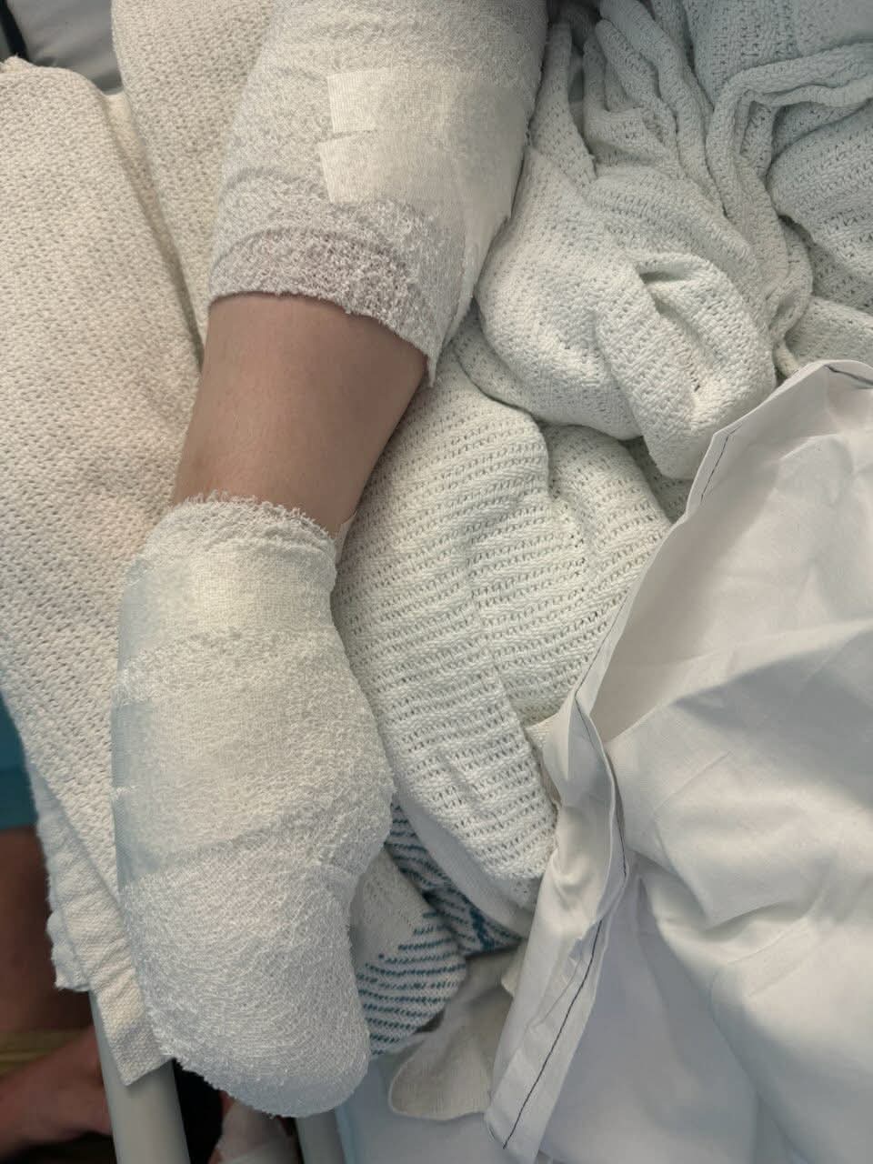“Help Casey Heal After a Traumatic Dog Attack” campaign photo, 4 of 6
