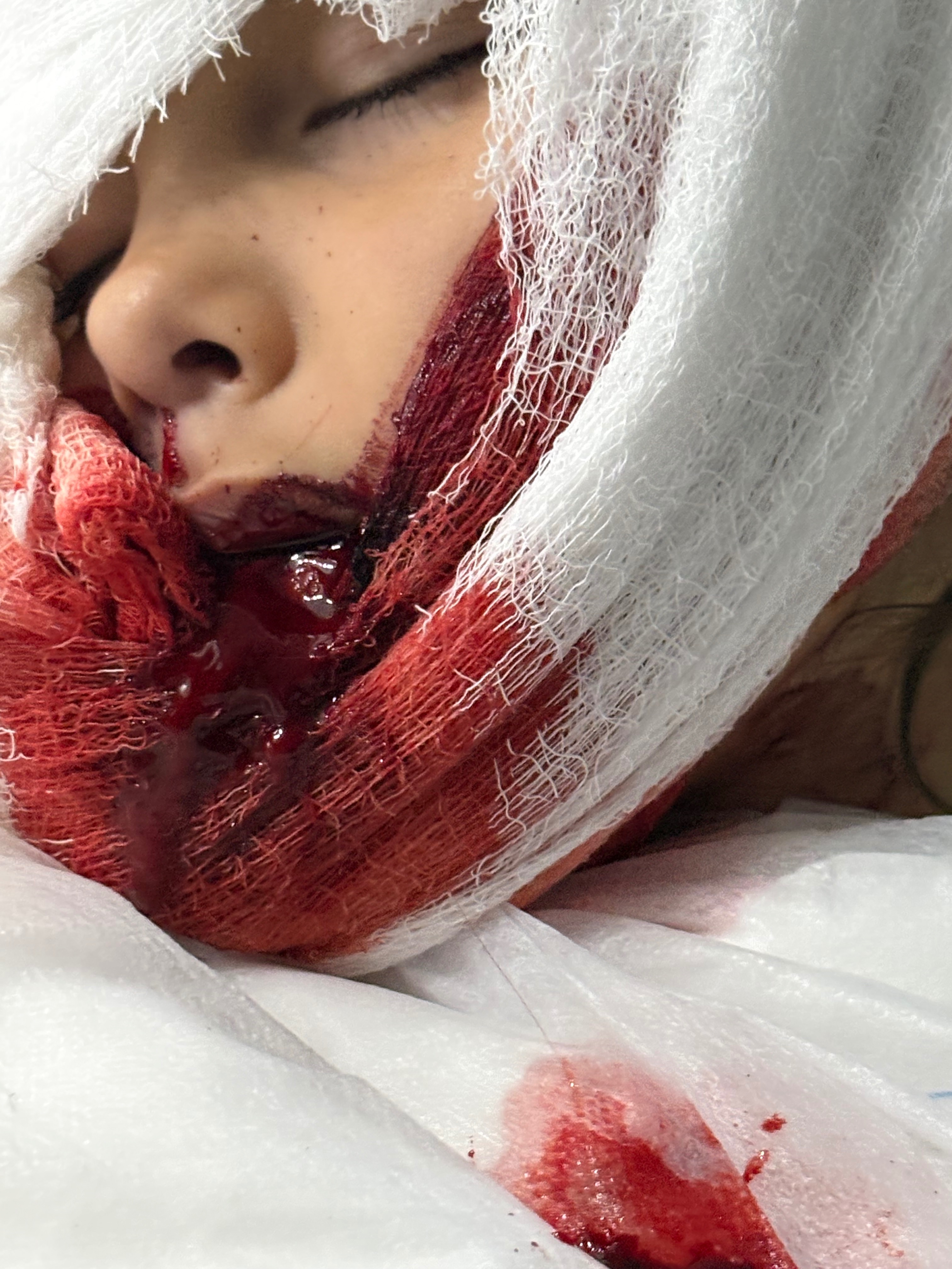 Support Savannah’s Recovery After Dog Attack campaign photo, 2 of 7