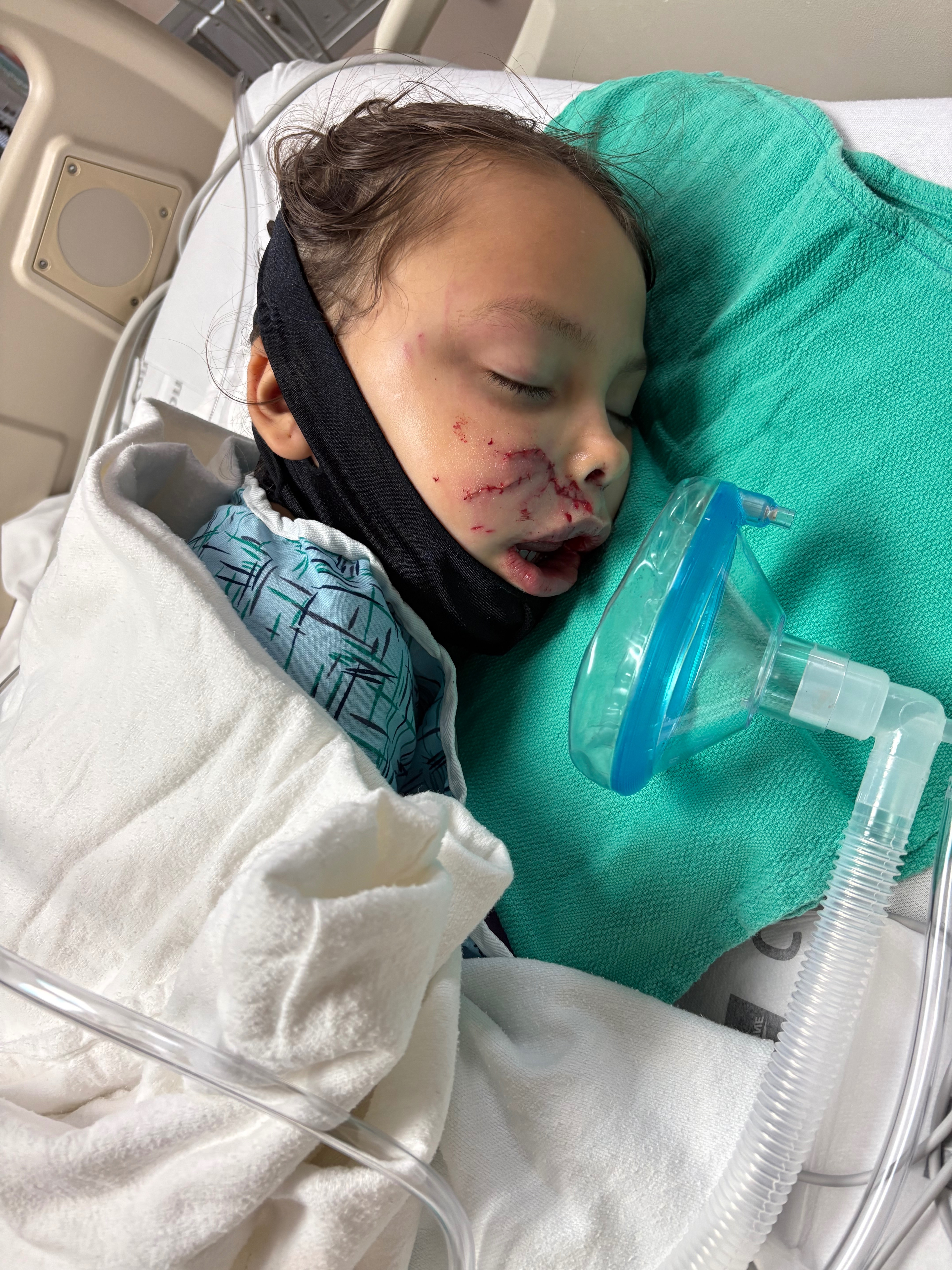 Support Savannah’s Recovery After Dog Attack campaign photo, 4 of 7