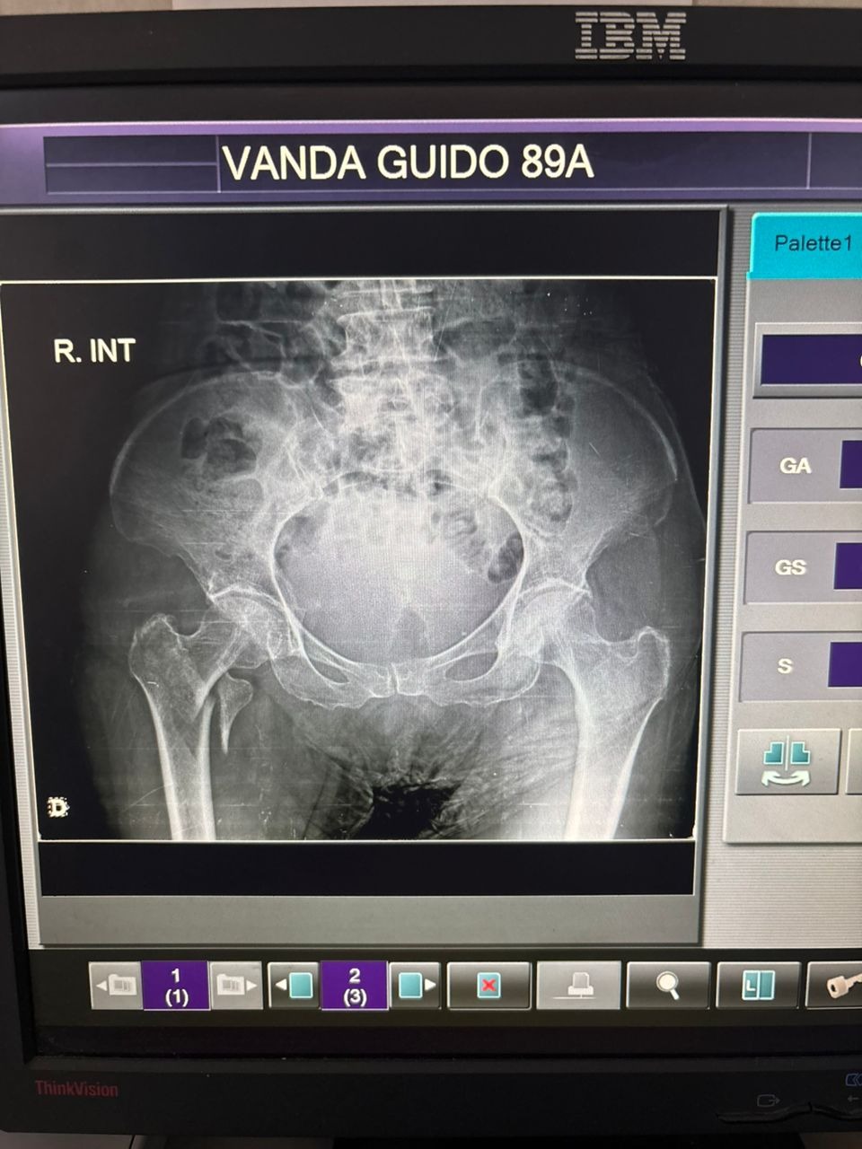 Ayudemos a Vanda Guido a pagar su Operacion de Cadera campaign photo, 4 of 7