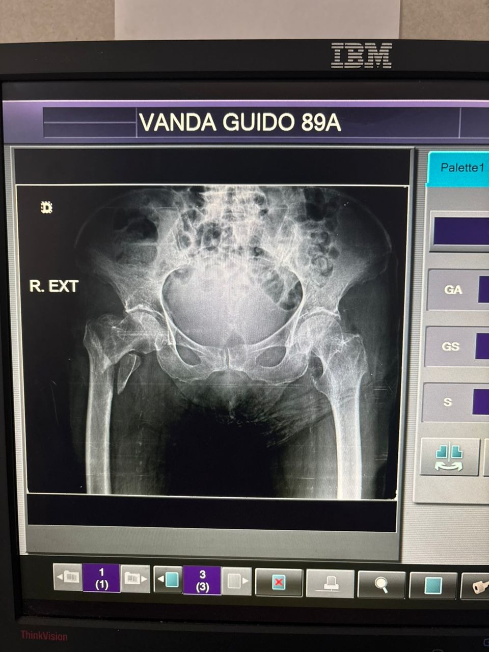 Ayudemos a Vanda Guido a pagar su Operacion de Cadera campaign photo, 5 of 7