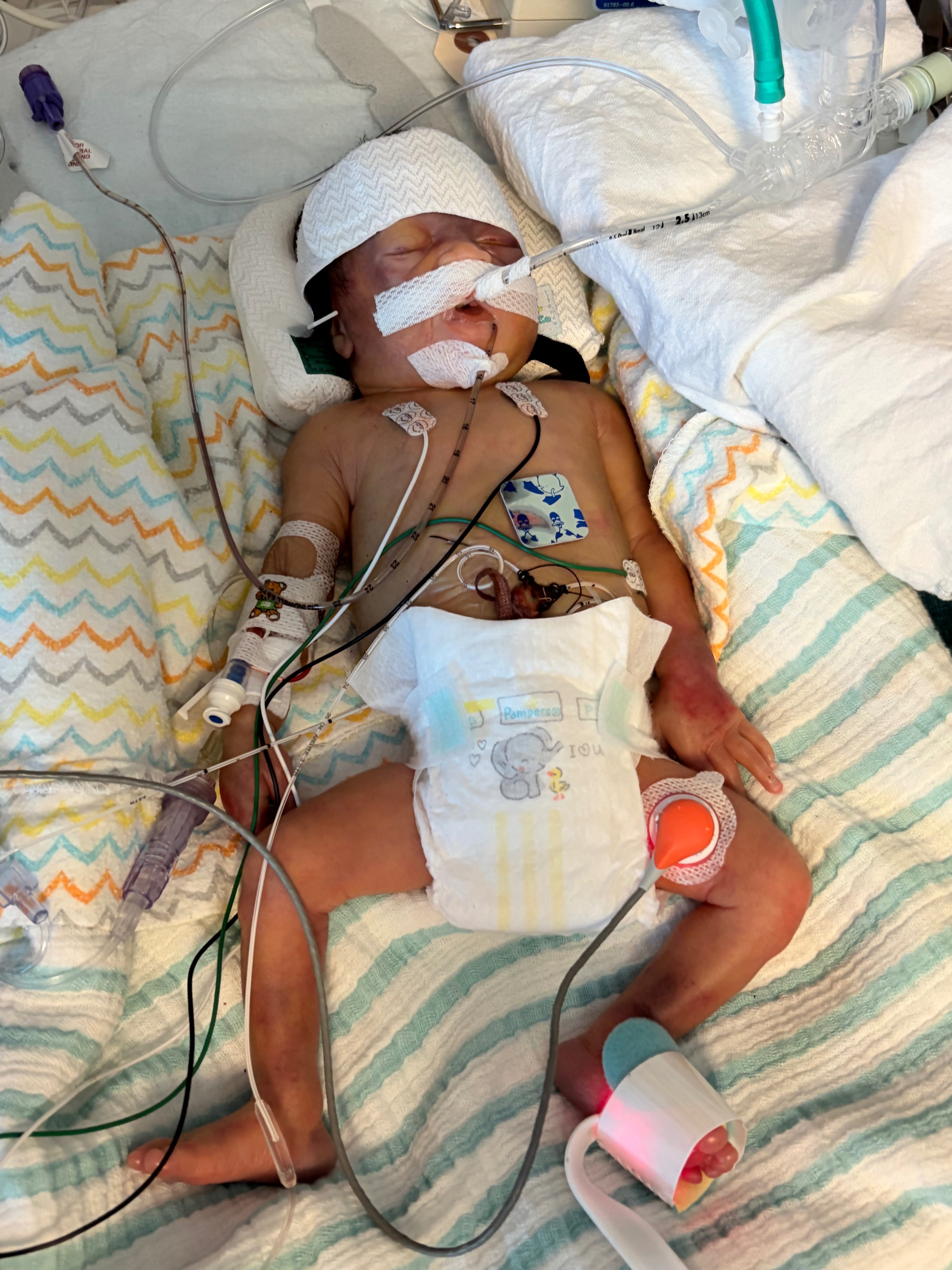 Support for Zileah After Loss of Baby Zi'mire campaign photo, 6 of 8